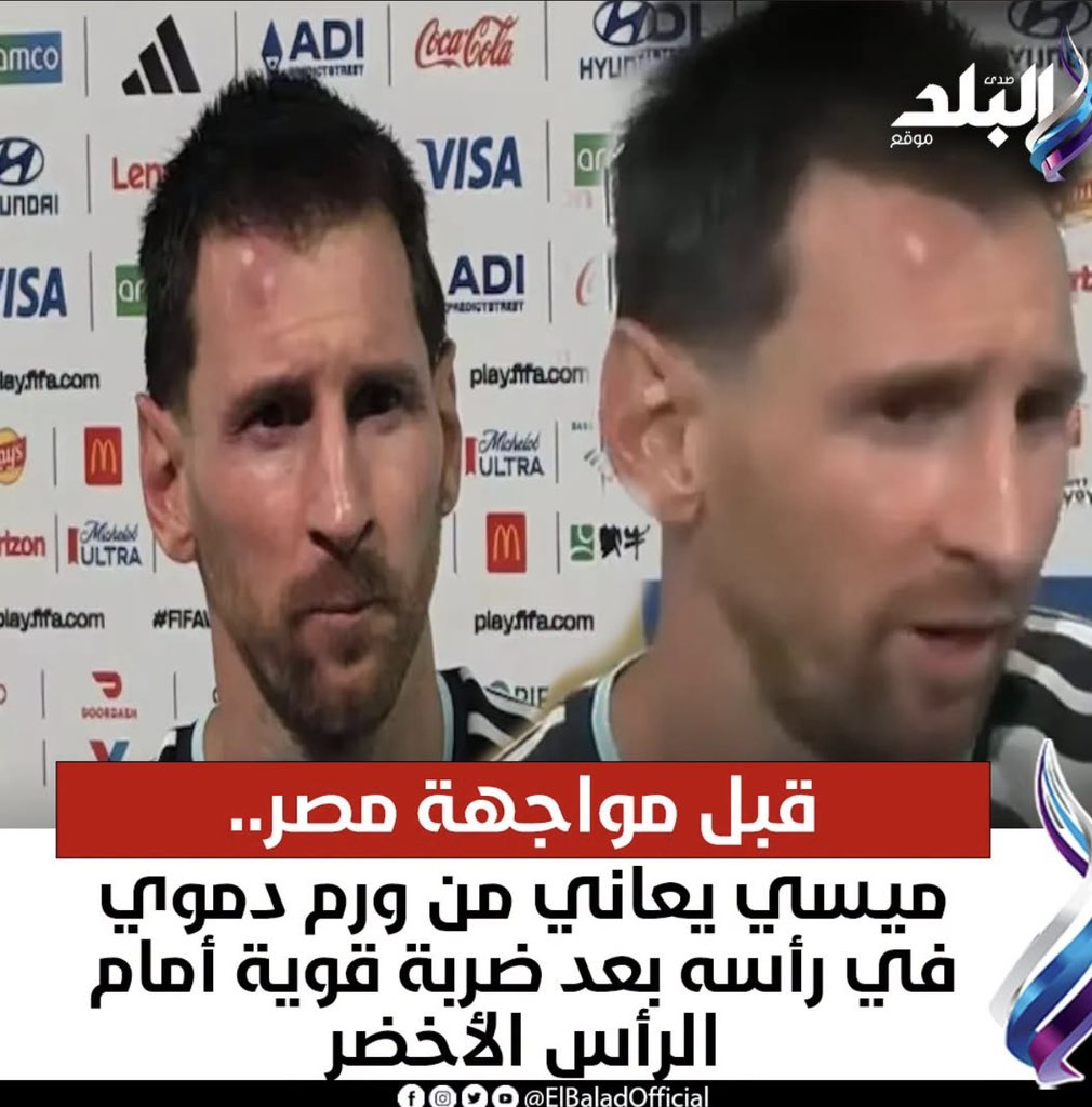 a7med_elsayed95's tweet photo. ي علياء بتعمليها ازاي https://t.co/iAi16J5GrO