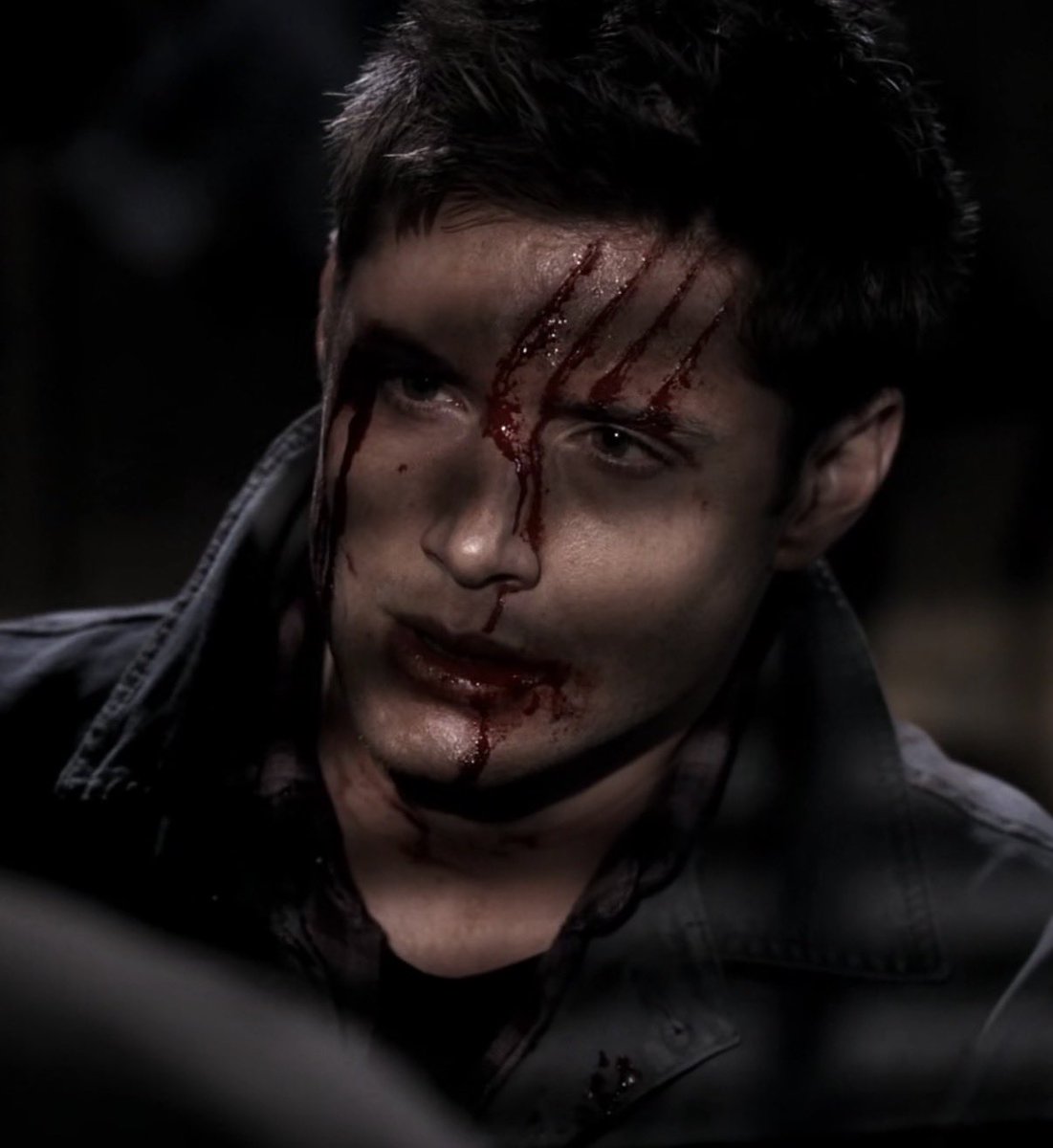 j2porn's tweet photo. i miss when sam and dean had actual gnarly scars and scratches on their faces. they looked so pretty all bloody https://t.co/5VqykPH4PG