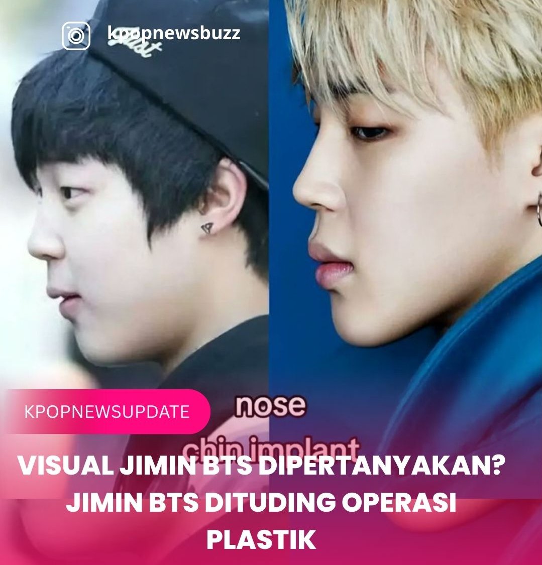 wirawan_exo's tweet photo. @tiaragultom17 gengsi bgt buat ngakuin idol lu gak ORI ya? di aespa yg op mah winter doang, itupun cuma hidung, selebihnya ORI, tapi di bts, ada JK, Jimin, Suga yg oplas. gpp sih oplas, yg penting bisa nyanyi, duit dipake buat oplas mampu, tp sewa guru vocal gk mampu wkwkwk https://t.co/c3kwYQKPZX