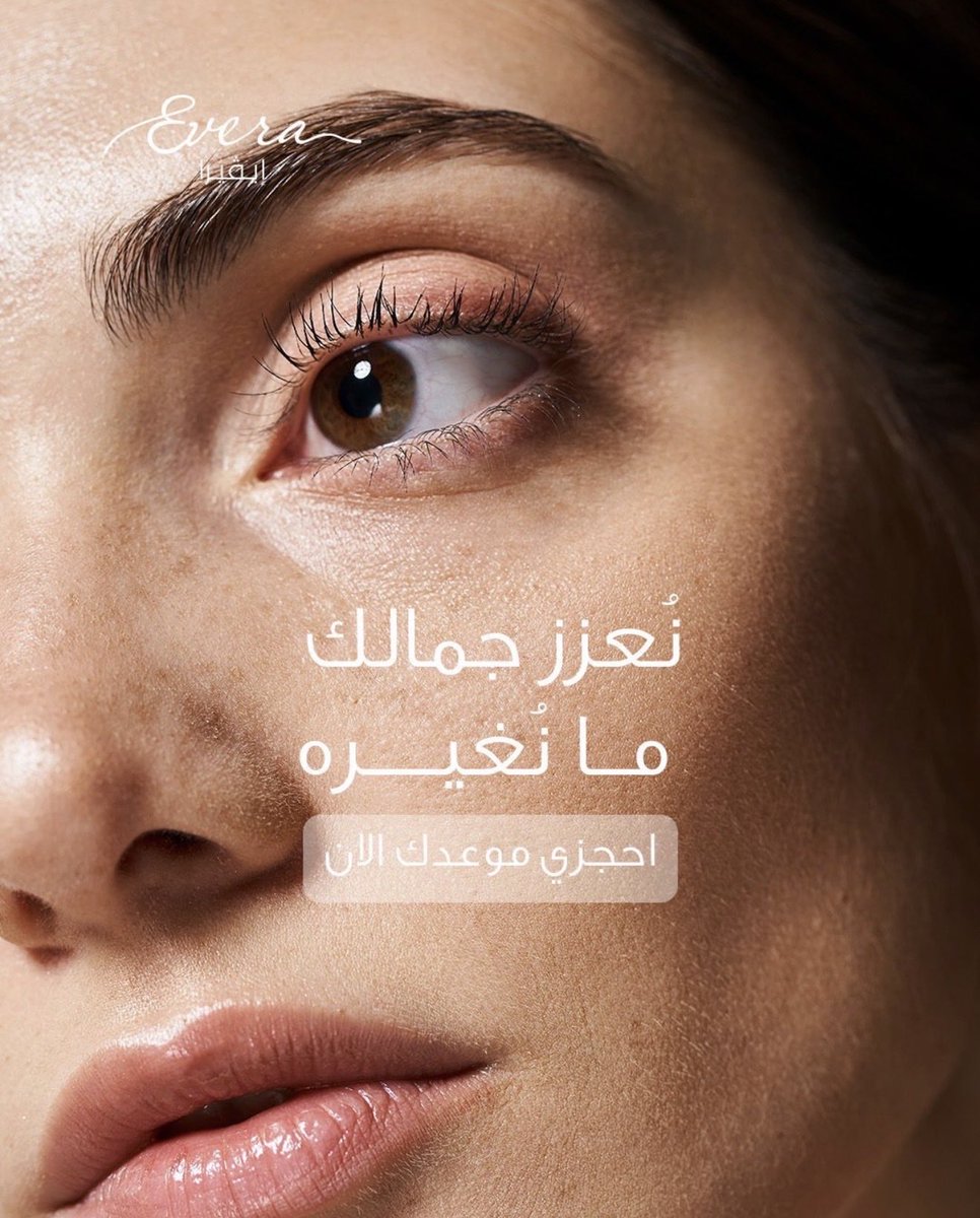 Evera_center's tweet photo. الجمال في إيڤيرا ما يتغير.. يزيدك حلاوة! ✨
احجزي موعدك الان

للاستفسارات والحجوزات نسعد باستقبال اتصالاتكم على أرقام العيادة

0112902229📞
0112799979📞

#عيادات_تجميل #عمليات_تجميل #تجميل https://t.co/4EupSJvH2J