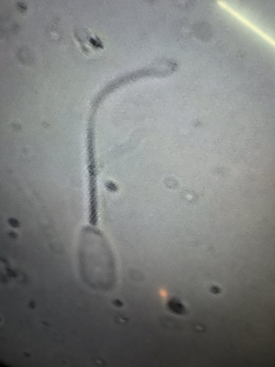 marinhoboschi's tweet photo. Test de HOST en semen https://t.co/BOa2SjeGkH