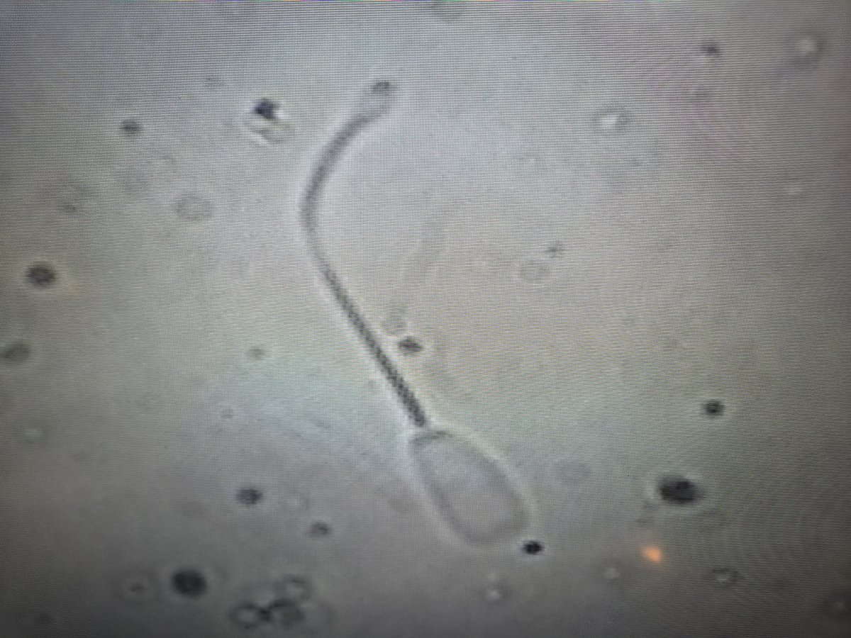 marinhoboschi's tweet photo. Test de HOST en semen https://t.co/BOa2SjeGkH