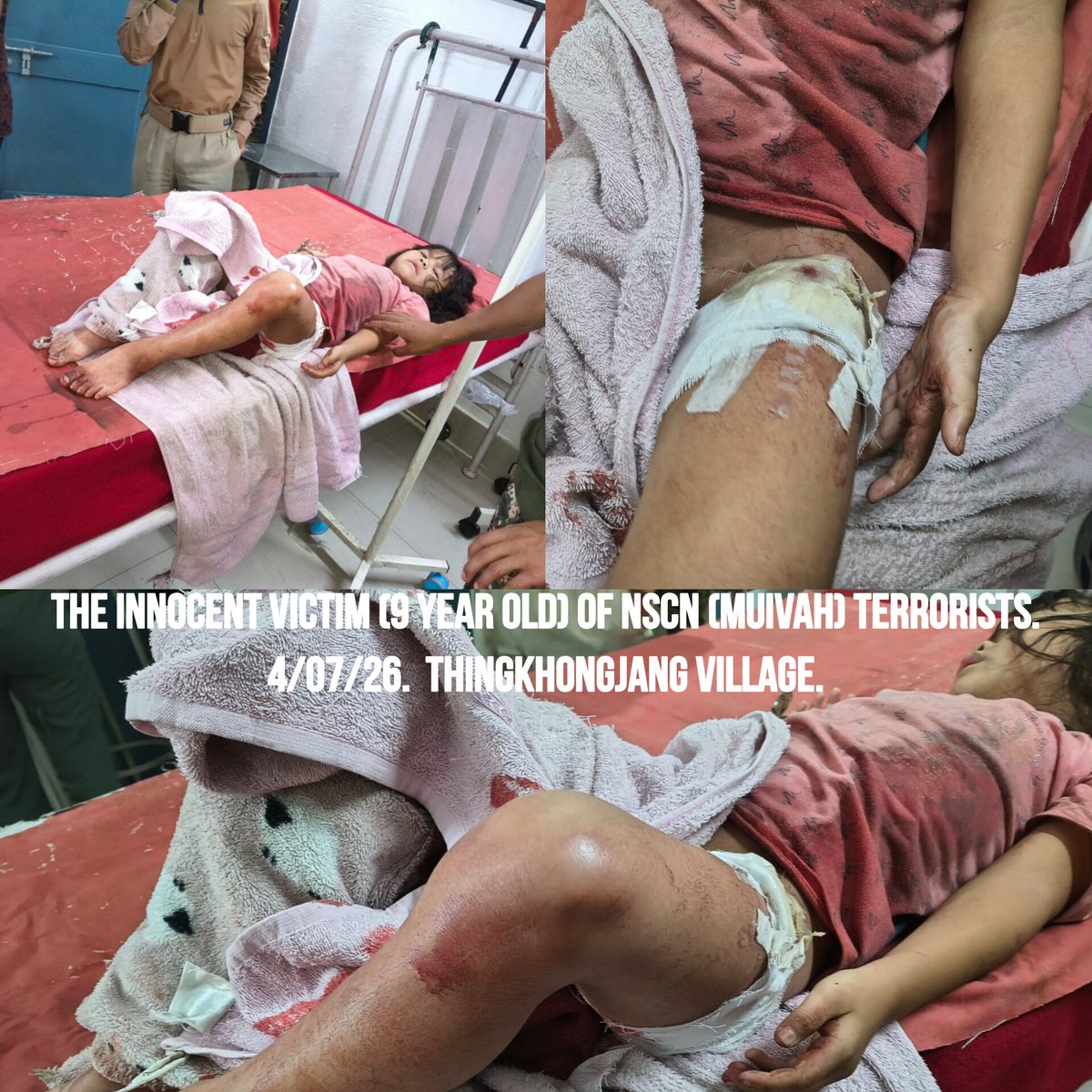 JShakurB's tweet photo. 🆘️Exactly 1 month after the NSCN (Muivah) terrorists savagely butchered a 7 month-pregnant mother & her unborn baby, the bloodthirsty predators have struck again to satisfy their insatiable lust for violence.

■Their latest targets this time is a helpless 9 year-old girl & a 56-year-old mother. Only by sheer miracle did the innocent victims survive but this latest act of Terrorism has exposed the bottomless cruelty & subhuman tactics of the NSCN (Muivah) Terrorists that preys exclusively on the defenseless.

@UNHumanRights @UN_Women @UN @UNinIndia @hrw @HRF @unwomenindia @NCWIndia @amnesty @AIIndia @CII_IWN @cii_iwnDelhi @ShekharGupta @gupta_rekha @nsitharaman @Annapurna4BJP @unwomenchief @JuliaGillard @INCMinority @BJPMinMorcha @ncsthq @NCM_GoI @UNinIndia @NCMEC @children @thewire_in  @UNICEF @UNICEFIndia @frontline_india @thewire_in @vijaita @sardesairajdeep @RahulGandhi @rajnathsingh @MukeshSinghIPS 
@LokBhavManipur @BhallaAjay26 @gpsinghips @ANI @AmitShah @PMOIndia @narendramodi @KonthoujamG @YKhemchandSingh
