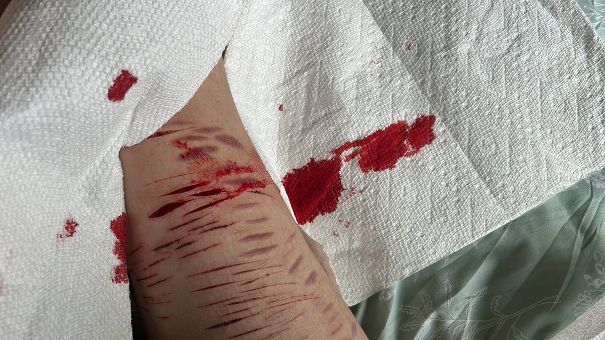 sweet_soul_dead's tweet photo. OKAY WE GET IR STOP BLEEDING https://t.co/9KSEcZnCVa