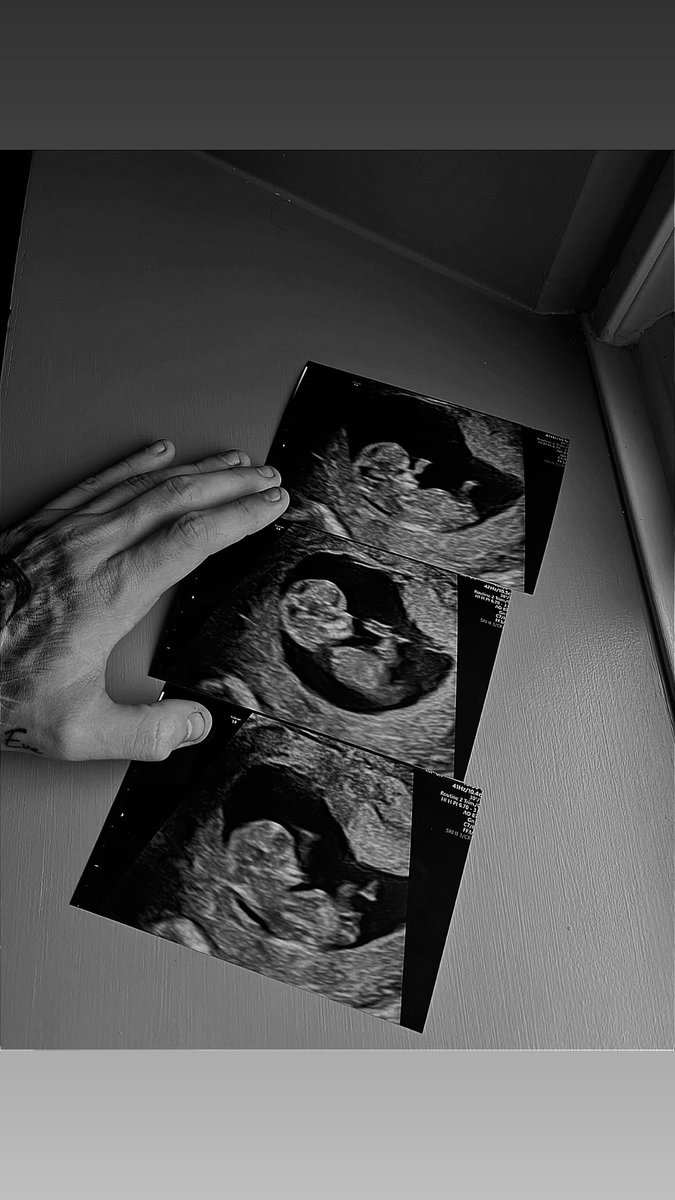 Dermz_'s tweet photo. I’m gonna be a dad 💙 https://t.co/8RltlRcgTn