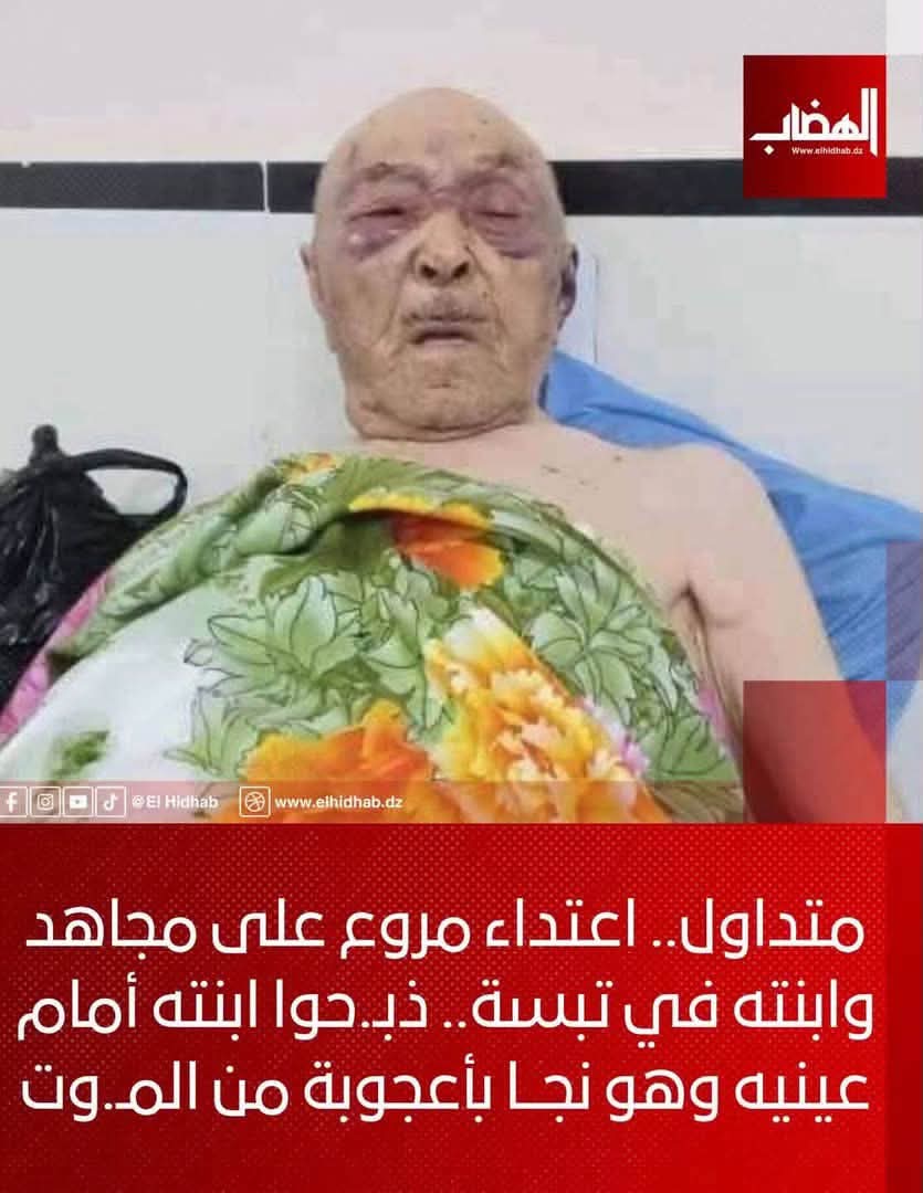 FEweZ9x1XJWkz3z's tweet photo. لا حول ولا قوة إلا بالله العلي العظيم
#المجاهدون الذي قدموا النفس والنفيس في سبيل الله ثم #الجزائر. عمي #معمر_شرفي مجاهد نقيب تجاوز 90 سنة من عمره وفي يوم 5 جويلية يعتدون عليه ضربا مبرحا ويقتلون ابنته امام عينيه، هذا أمر لا يمكن السكوت عليه..
#الجزائر https://t.co/5yvg4gINR6