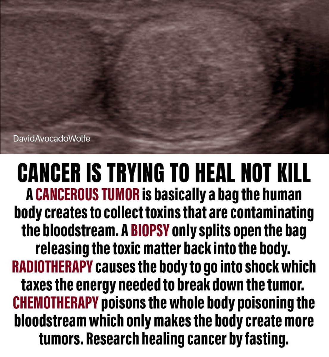 DavidWolfe's tweet photo. https://t.co/yib4FeLJUW