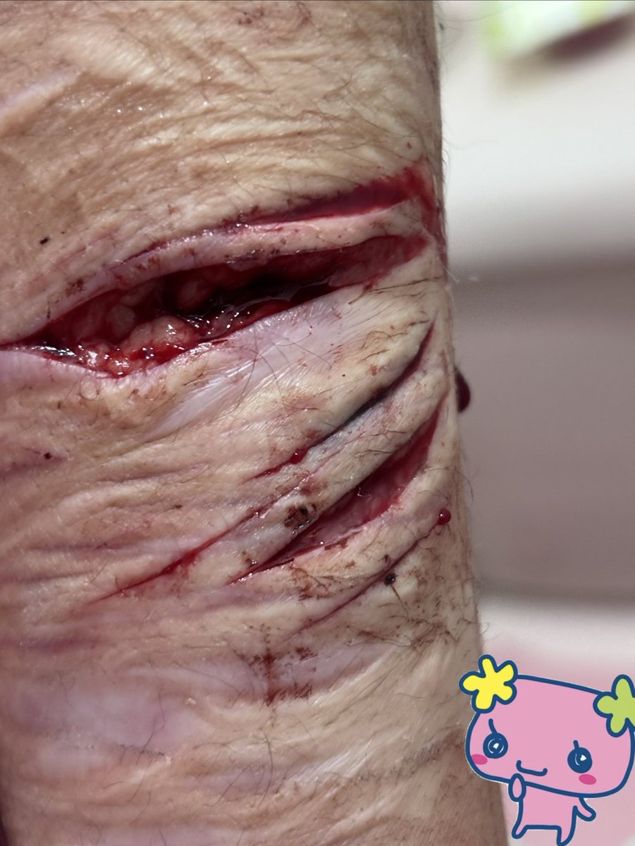 MvLll_k4sh's tweet photo. sfx makeup #shtwt #shtw https://t.co/qD9fNOdqOL