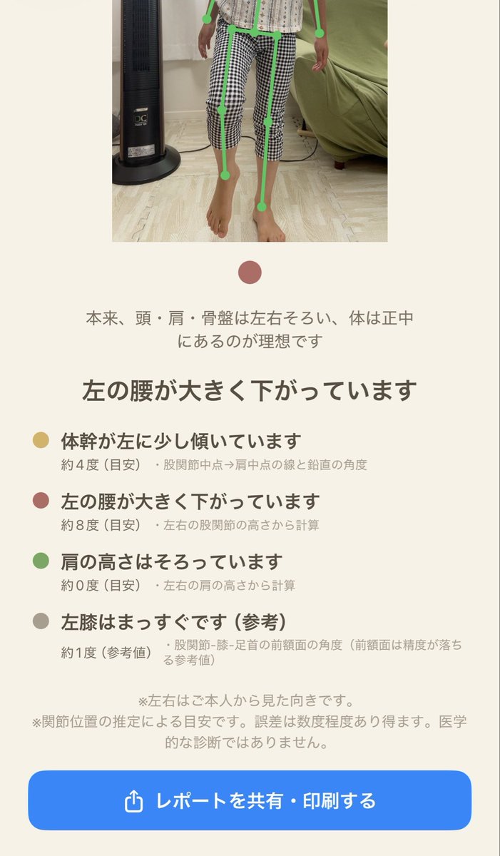 happyandpt's tweet photo. 初めてのiPhone用アプリ開発❣️

新井だけにアライメント🌟w

左右差やビフォーアフター、経過をみれるようにグラフ化も行った。

これから実際に使ってみて、
UIや精度などを検証して最終的に病院のiPadに入れて患者に使えるようにしようかと思う。 https://t.co/45P0iqLspR
