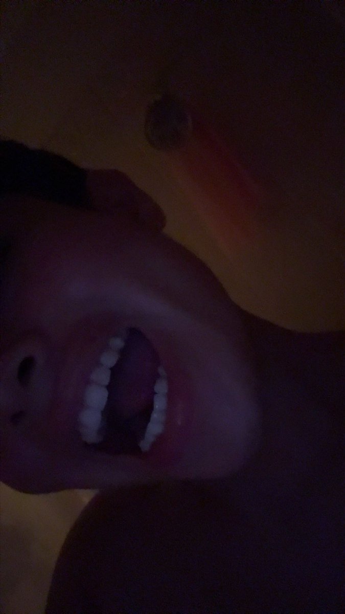 _lovepineapples's tweet photo. should i rock sum teeth gems or na https://t.co/vyUaKfpVH4