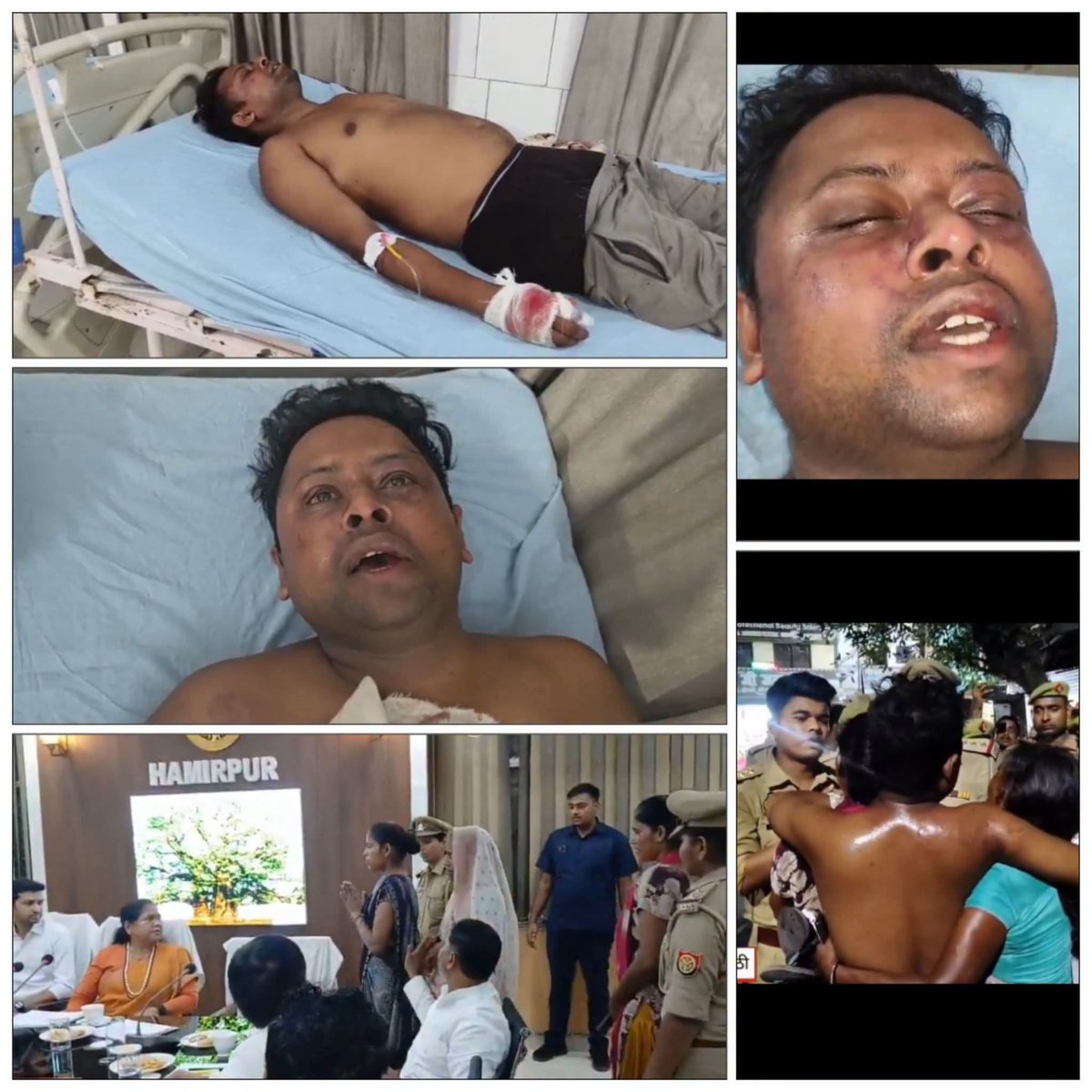 ChitranceManoj's tweet photo. @dgpup @myogiadityanath @homeupgov @dmhamirpurup हमीर पुर में एक थाने के अंदर बिना शिनाख्त गलत व्यक्ति को वारंटी समझ कर थाना प्रभारी ने दी थर्ड डिग्री। शिकायत करने पर पुलिस दे रही परिवार को झूठे केस में जेल भेजने की धमकी,कृपया कार्यवाही करे।। https://t.co/0pnMeTehQ4