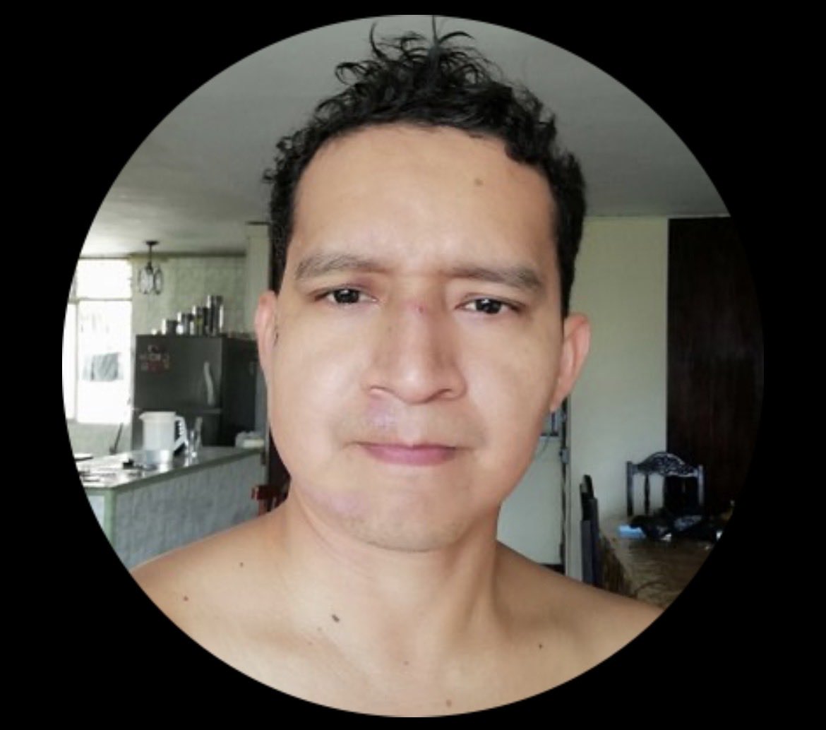 leolu_86's tweet photo. @anibalchoez @miseleccionmx Este adefesio mal parido nos dice horrendos 😂😂😂😂 el chiste se cuenta solo 😂😂😂😂 https://t.co/apAaufrPsU