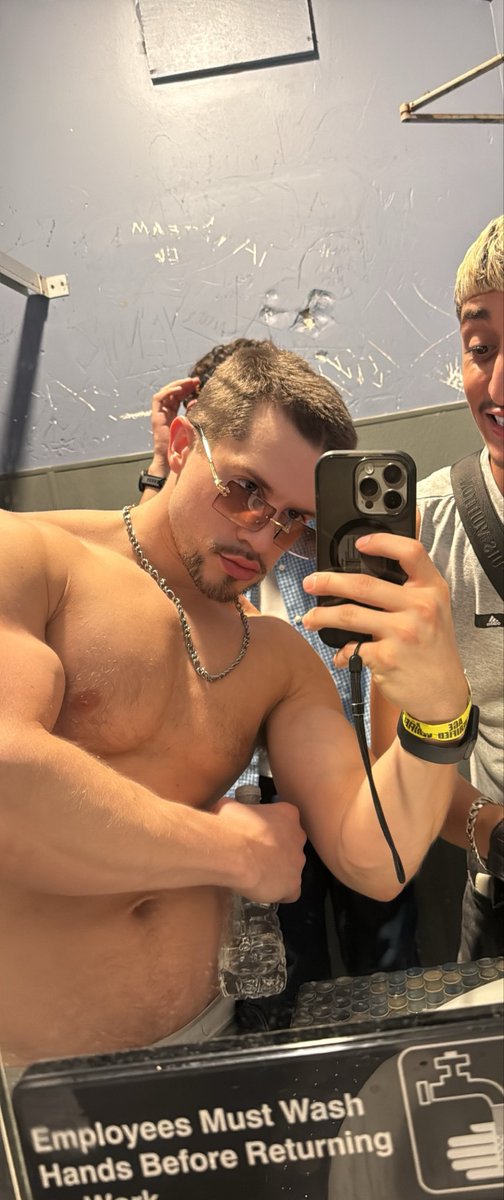 xjosef69's tweet photo. My hair after my transplant is finally starting to grow 🤩 https://t.co/LJ33javDr8