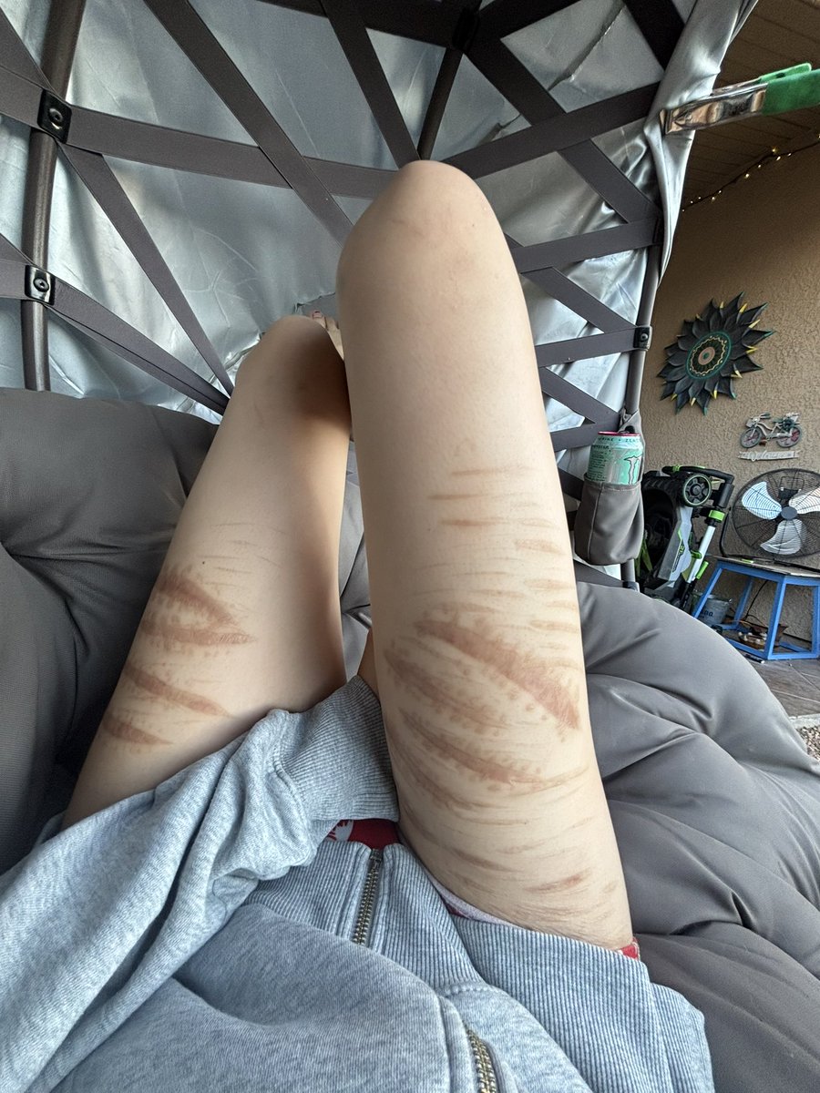 microdxse's tweet photo. the size of my thighs looks so good when i hold back all the fat i need to lock in fr https://t.co/vPeC1uuENb