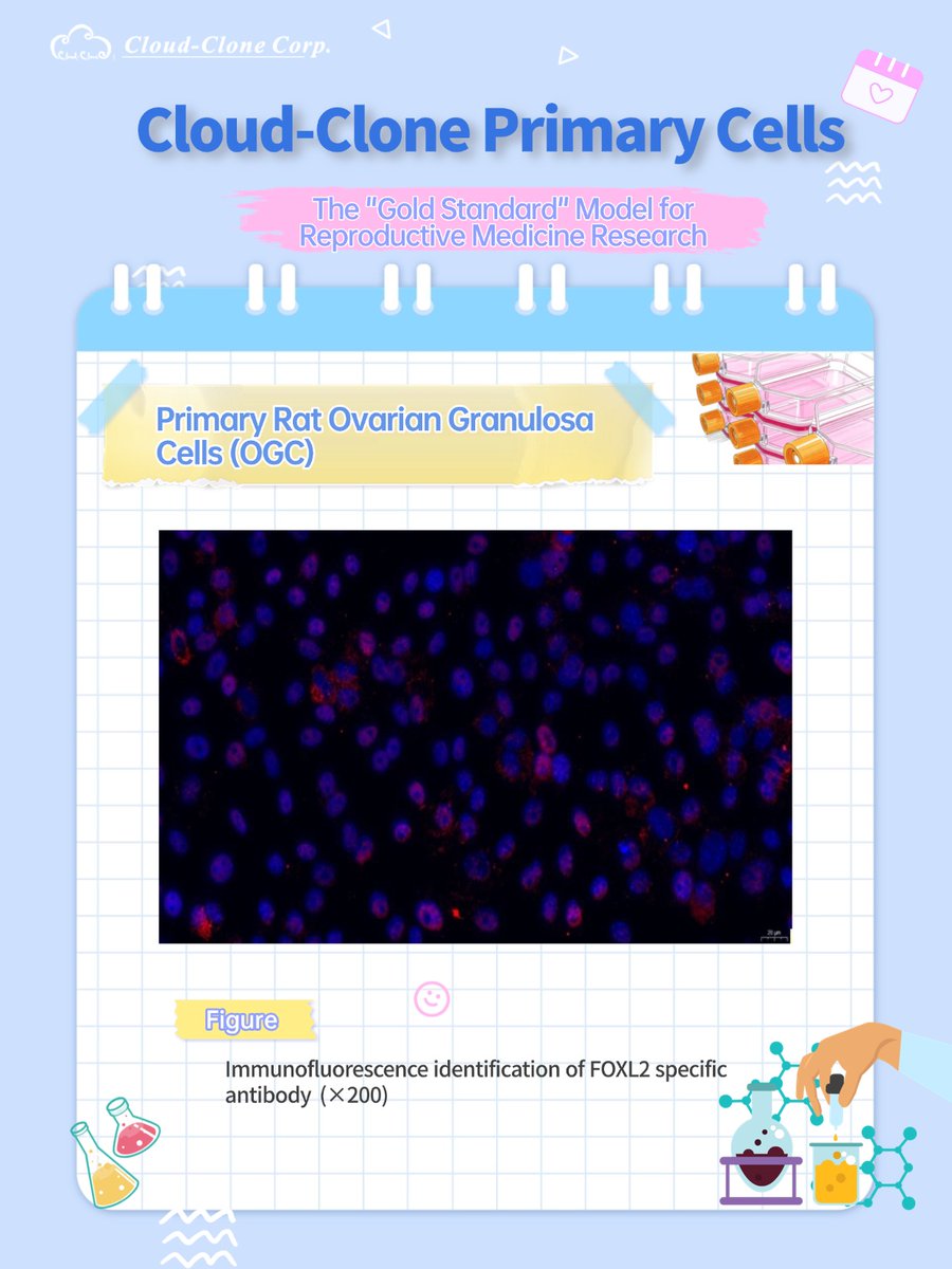 Cloud_CloneCorp's tweet photo. 🎉Cloud-Clone Ovarian Granulosa Cells (OGC) Recommendation
📝Ovarian Granulosa Cells (OGC) control follicle growth, ovulation and hormone production, acting as key in vitro models for ovarian aging, PCOS and drug trials. https://t.co/ZVdrg7W4iE