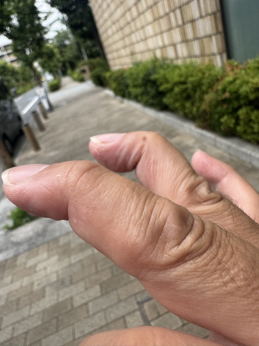 TH_PRO37's tweet photo. 指の第一関節だけを曲げる事が出来ます。プロレススーパースター列伝で、初代タイガーマスクがトップロープの上で披露して、空手の達人だけが出来る技と紹介されていました。#スカロケ #特技 https://t.co/LGs4vtv6K5