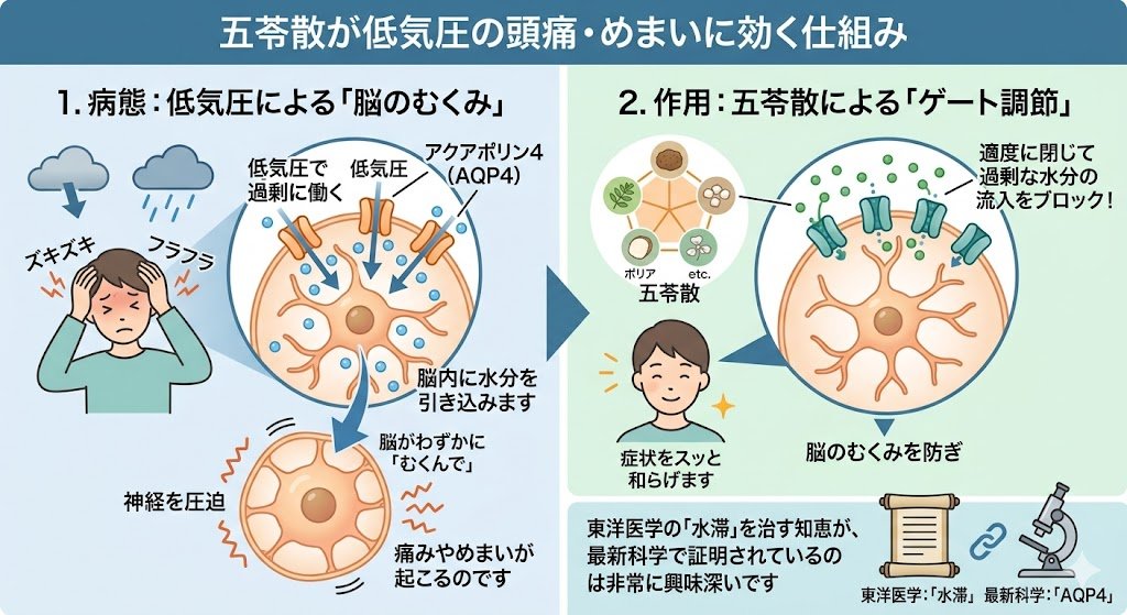 mizuho_kampo's tweet photo. 【五苓散は脳のむくみから起こる頭痛やめまいに効く】
低気圧の時の頭痛やめまいに使われる事が多い五苓散。
五苓散がそれらの症状に効果がある仕組みが現代研究によりわかってきました。

カギは脳細胞にある水分のゲート「アクアポリン4」。気圧が下がると、このゲートが過剰に働き、脳内に水分を引き込みます。その結果、脳がわずかにむくみ神経を圧迫し、痛みやめまいが起こるのです。

五苓散は、このゲートを適度に閉じて過剰な水分の流入をブロックして脳のむくみを防ぎ、頭痛やめまい和らげます。

漢方の「水滞」を治す仕組みが、最新科学で証明されているのは非常に興味深いですよね。