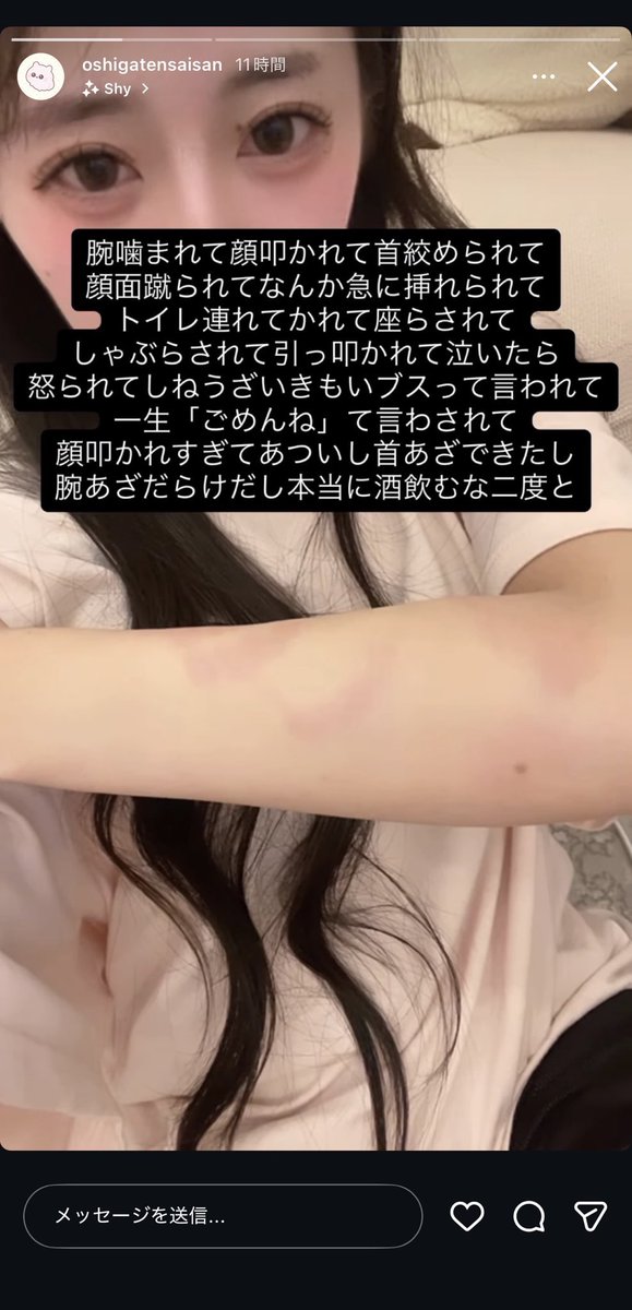 orihara_bakuro's tweet photo. 【ユグドラシル】

ユグドラシル 本店 道枝響

説明
エースの姫からホストテロを喰らう。
道枝響よりDVを受けたかのようなsos https://t.co/dmsnHwB6R8