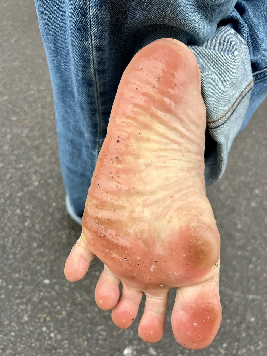 PikarinFootLove's tweet photo. 雨で濡れた路面を裸足で歩くのめっちゃ気持ちよかったぁ〜🦶💦
#裸足 #足裏 #barefoot #sole https://t.co/0DRxemMs45