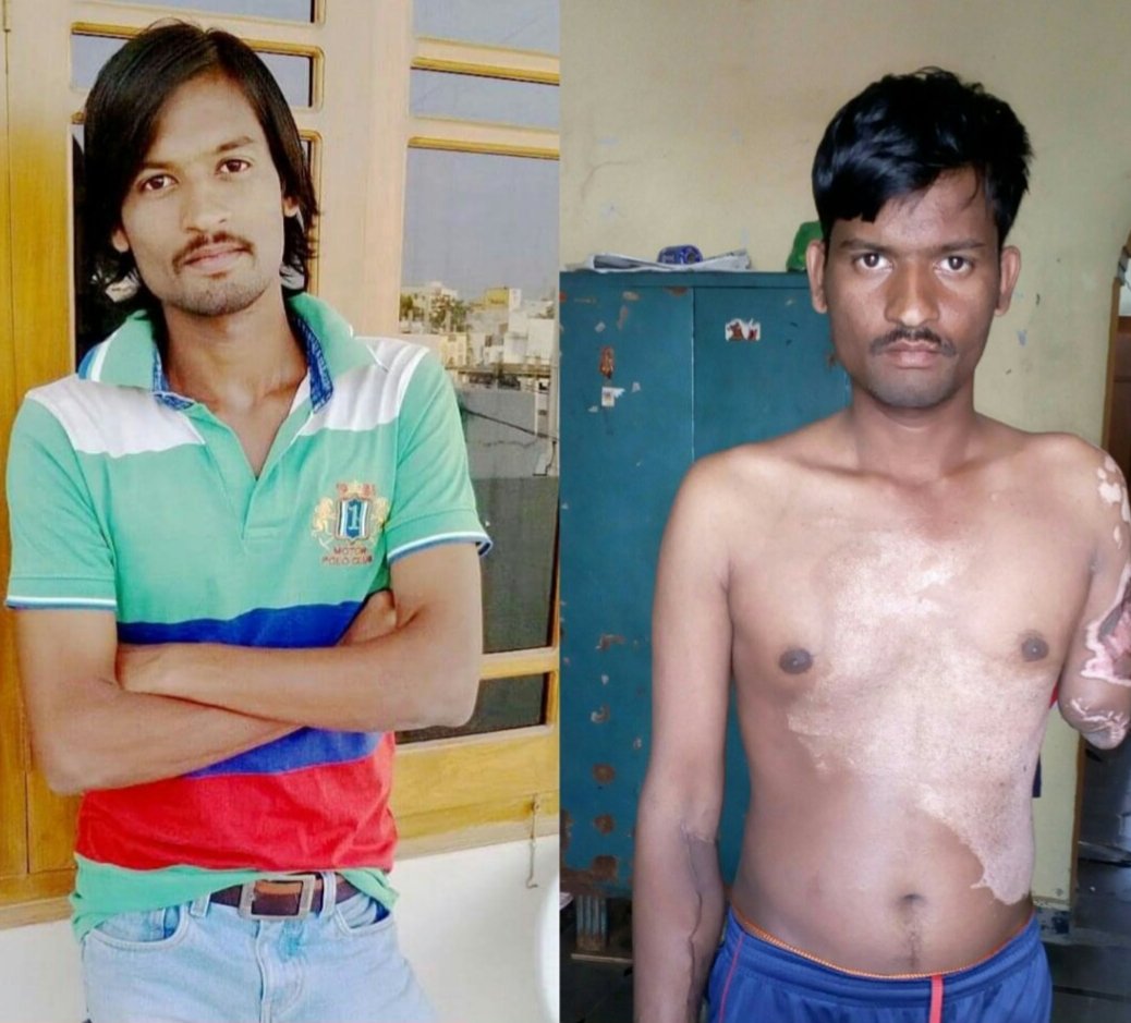 manikeshwar1's tweet photo. @SonuSood Hello sir my name is manikesh and i cannot work  because I got electric shock please give me some help https://t.co/HaozBhUggd