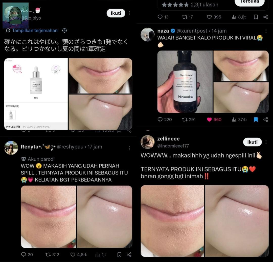 Tanyarl 💚 tweet media