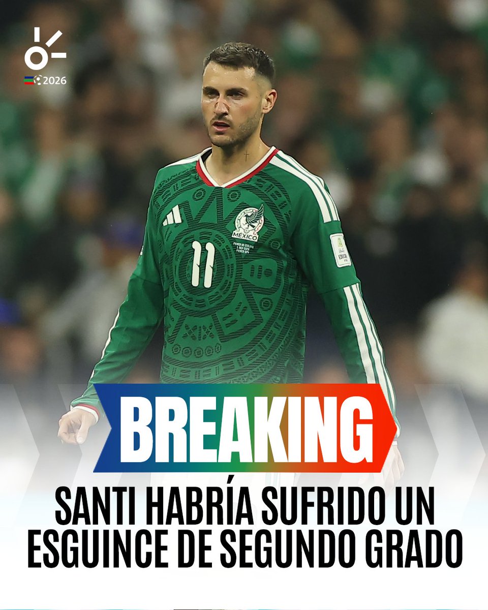 ClaroSports's tweet photo. ¡PREOCUPACIÓN POR SANTI GIMENEZ!🤕🇲🇽

Claro Sports pudo saber que Santiago Gimenez fue sometido a estudios médicos, los cuales habrían arrojado un esguince de segundo grado en el tobillo derecho. De confirmarse el diagnóstico, el delantero mexicano podría estar fuera de las canchas entre tres y seis semanas, dependiendo de su evolución y del proceso de rehabilitación. 
📸 @alejandrasua