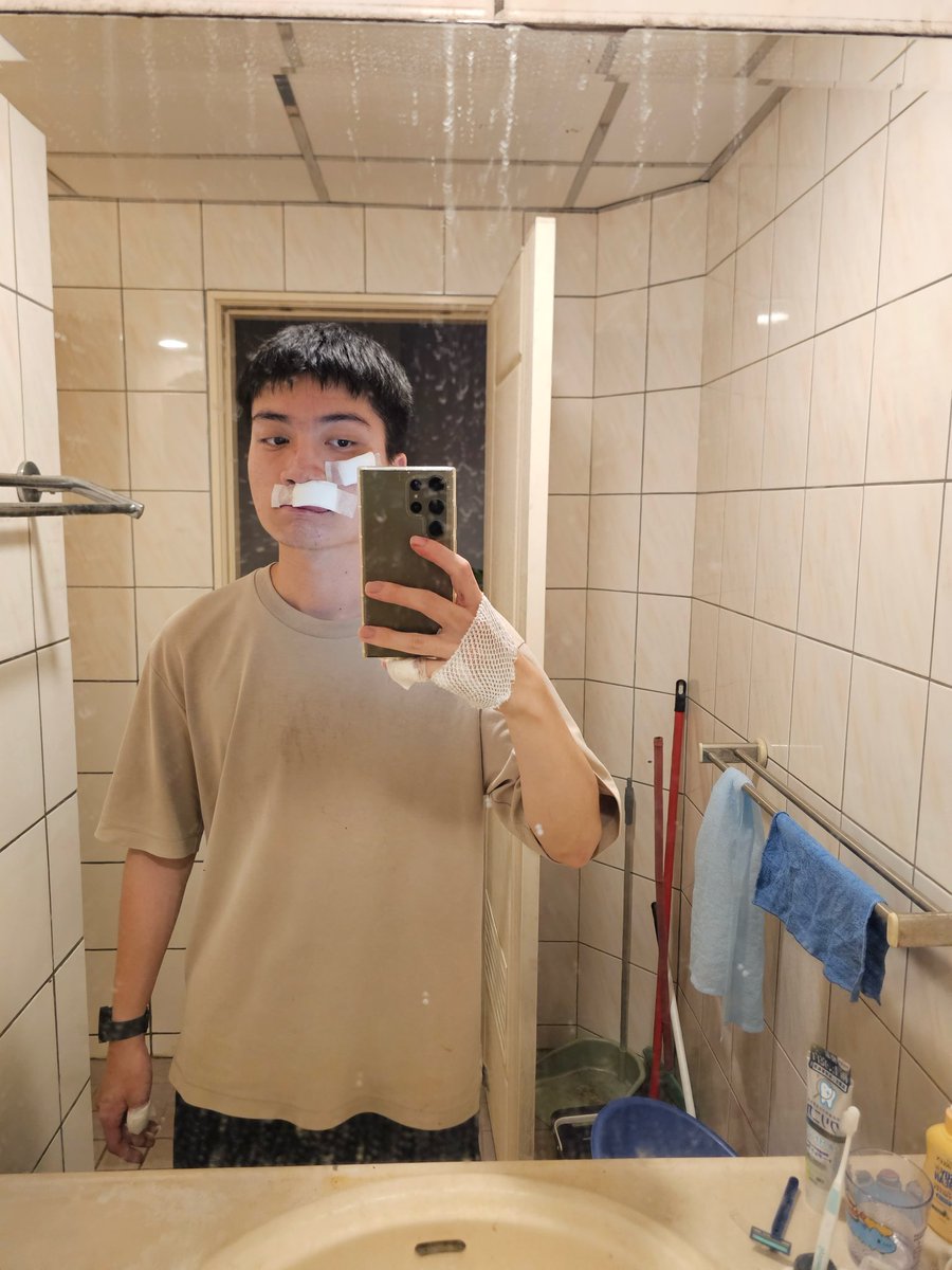 newmichael0206's tweet photo. 欸都，大家騎腳踏車要注意安全喔😅
人行道路況多變，要慢慢騎不可以搶快喔～
滿好笑的是，昨天我在 Ubike 站前面不到幾公尺自摔
原本從長庚醫院騎回長庚大學，結果又被救護車載回長庚醫院…
總之，現在就是好好養傷，之後臉上可能會出現兩個疤
不過已經有很多痘疤了…應該沒差啦🤣 https://t.co/mcUW7clxkw