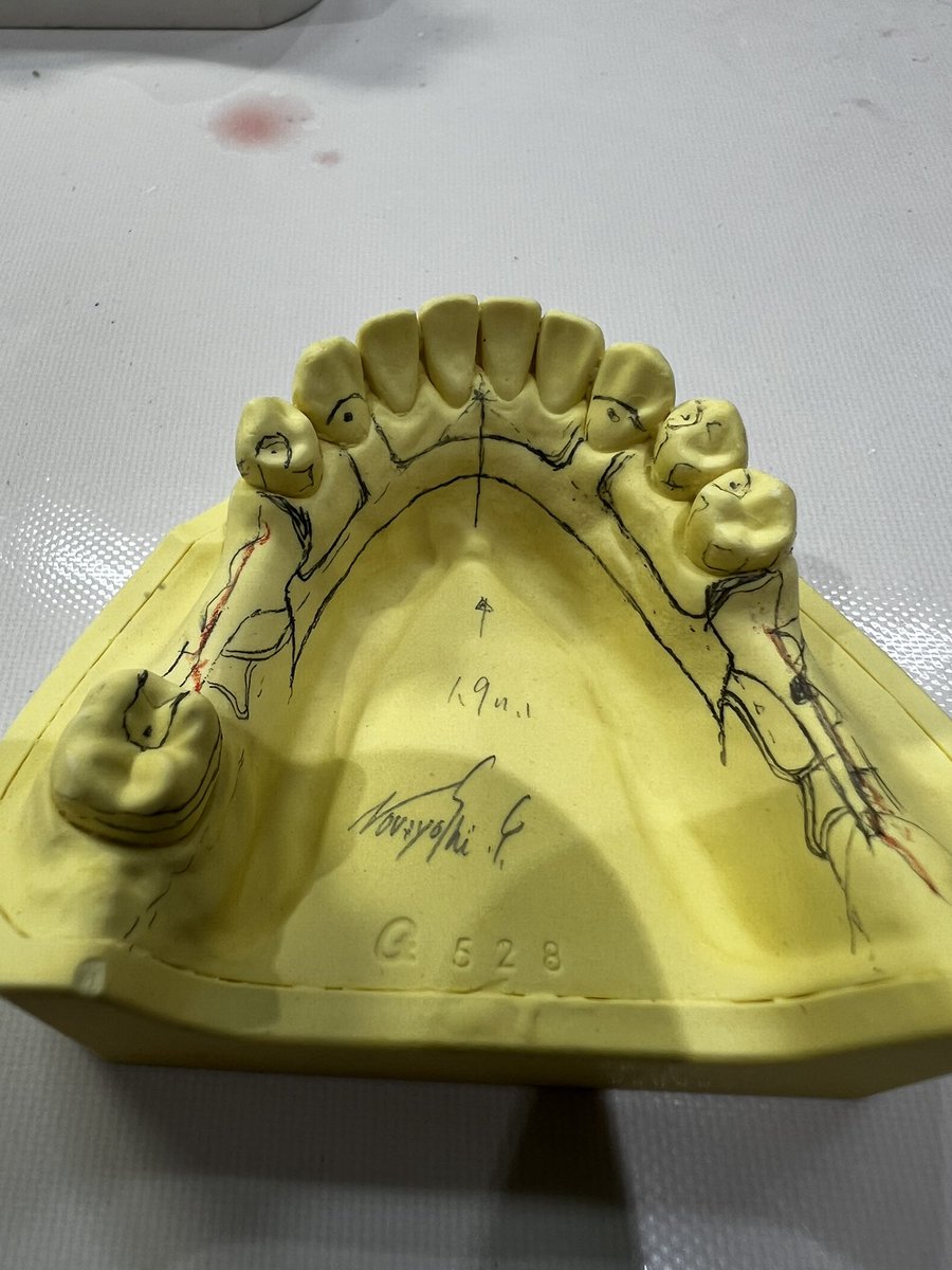 dentaltechnic16's tweet photo. 設計・デザイン。 https://t.co/8mMx9vbUXP