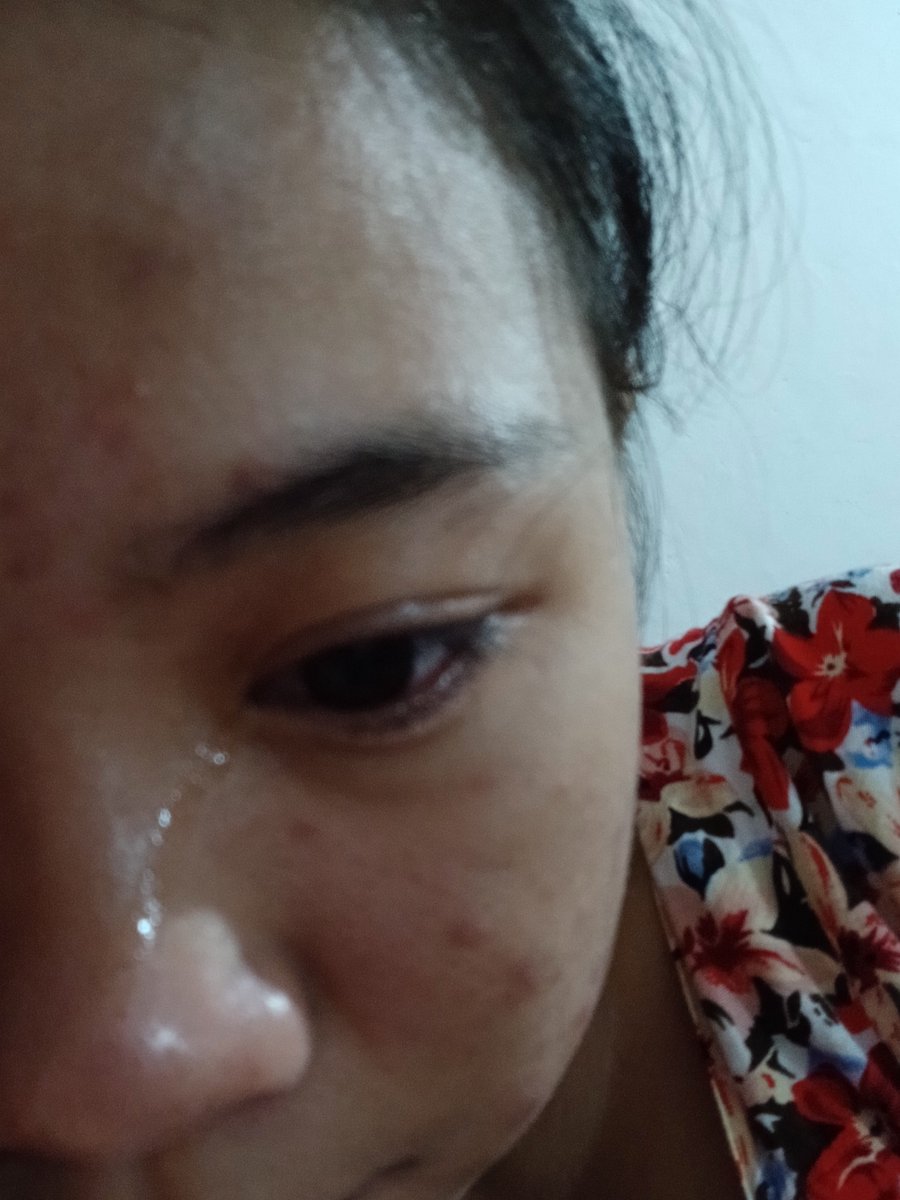 itssswoman's tweet photo. Aku ga pernah ngomongin org, ga pernah mengolok2 kesalahn apa lgi kekurangn org lain, tapi kenapa ya org2 tuh jahat banget, mereka g pernah mikirin org sakit apa ngga sama ucapan nya.
kalo bisa milih aku jga ga mau kaya gini https://t.co/sKV2vE1Vfd