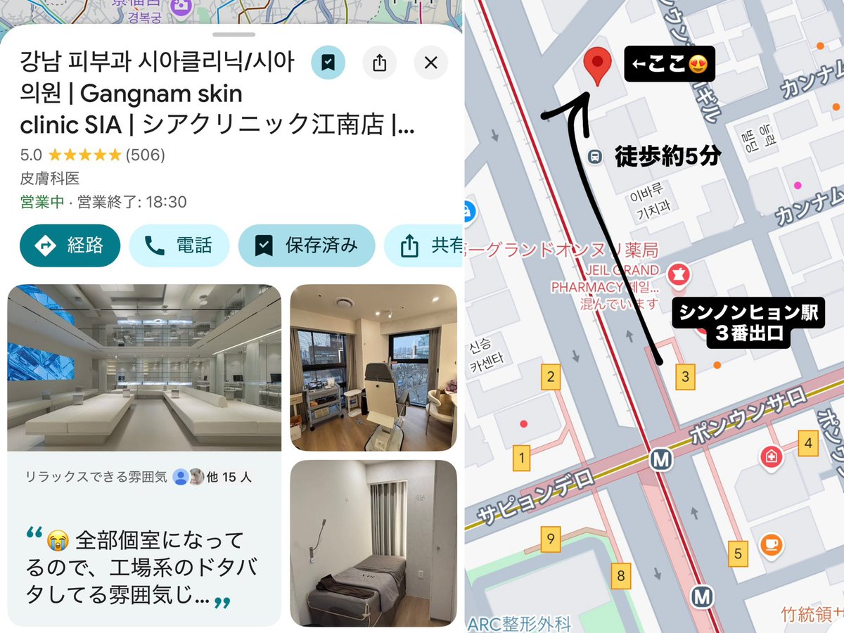 2024_0406's tweet photo. リップフィラーの神がいる＠siaclinic_jp 完全個室で高級皮膚科って感じだけど、工場系よりも安かった😂😂😂😂😂😂
👇これ全部3,000円くらい𝐰𝐰𝐰𝐰𝐰

✔︎ ピコシュアトーニング＋パック　
✔︎ LDM水分再生6分　
✔︎ ブラックピール＋パック
✔︎ シュリンクユニバース100shot

他にもララピール・スキンボト・サーモン注射3ccは59,000ウォンとか😂😂

このクオリティで超流れ作業の工場系より安いってどゆことシアクリニック。バグすぎる。
今回の渡韓で1番の大発見👏 渡韓の度通う‼️