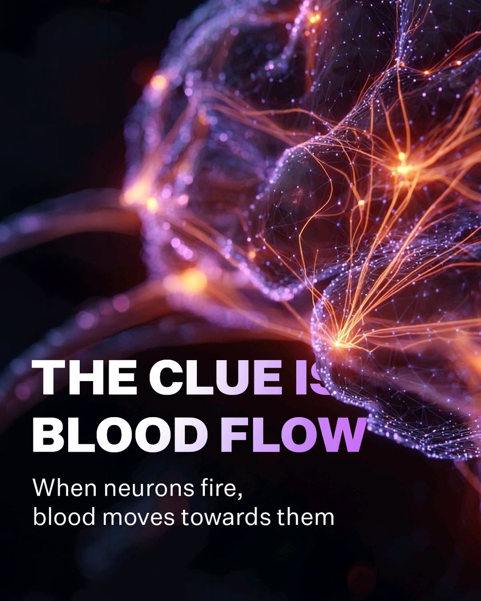 DubaiFuture's tweet photo. Mind interfaces have a hardware problem.

Aleph is exploring ultrasound imaging that maps blood flow through the living brain, using the connection between neural activity and vascular movement without bulky machines. 

When neurons fire, blood follows.

That could open a new path towards understanding the brain, and predicting diseases long before they happen. 

#DubaiFuture