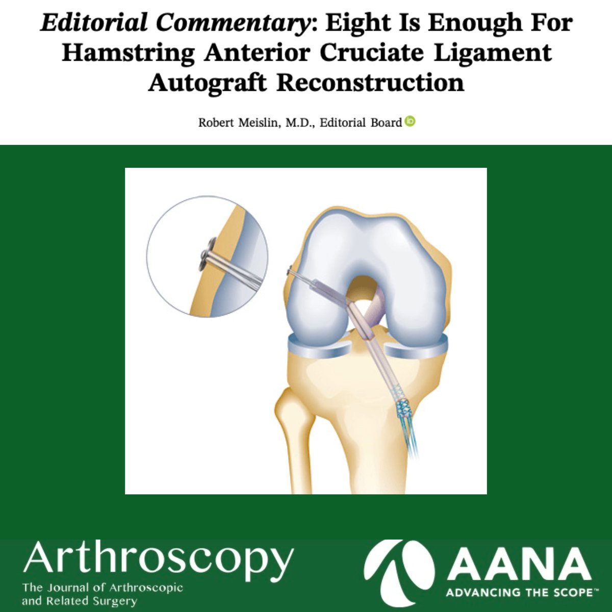 ArthroscopyJ's tweet photo. Eight is enough! πͺ This editorial explores why hamstring autografts β₯8 mm can match BPTB and quadriceps tendon outcomes. @robmeislin
https://t.co/TnAVECaiZe
#HamstringAutograft #ACLReconstruction https://t.co/FuO9yZ7Tin