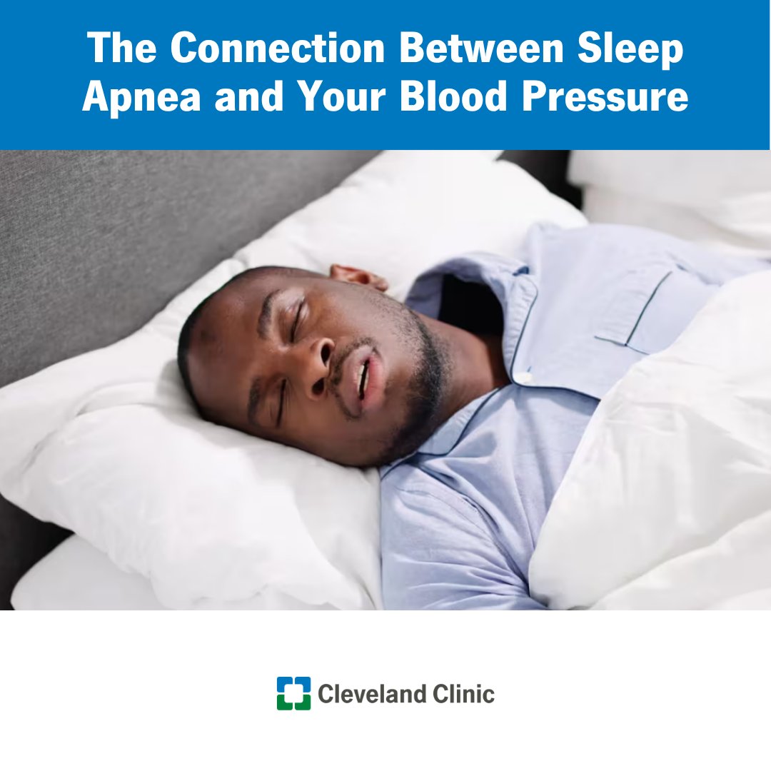 ClevelandClinic's tweet photo. Obstructive sleep apnea (OSA) can raise your risk of high blood pressure (BP). And the opposite is true, too: Hypertension can make sleep apnea worse. You can have one without the other. Of the two types of sleep apnea (obstructive and central), obstructive sleep apnea is more commonly associated with unmanaged high blood pressure. It’s also the most common kind.

When you have obstructive sleep apnea, the muscles in your mouth and throat relax too much while you sleep. That causes your airways to collapse and your breathing to pause as you snooze. OSA can affect the quality of your sleep (and that of anyone sharing a room with you, if you snore).

Normally, your body uses sleep as a time to recover. Your heart rate slows, your stress hormone levels fall and your blood pressure dips. That gives your heart and blood vessels a chance to rest. But when sleep apnea repeatedly interrupts your sleep, you don’t reap those benefits. When our sleep is restful, our blood pressure is supposed to decrease. OSA has the opposite effect. If you have OSA, your body stays on high alert throughout the night.

When you have sleep apnea, your oxygen levels drop and activate your body’s fight-or-flight response. That causes a surge of stress hormones (cortisol) that signal your blood vessels to tighten and raise blood pressure. Over time, those repeated stress responses can strain your heart and blood vessels.

Now, for the other side: If you have high blood pressure, you can be at higher risk for developing obstructive sleep apnea. That’s especially true if your blood pressure isn’t well managed with medication or other treatments.

Unmanaged blood pressure can result in fluid buildup or swelling in the body. When you lie down at night, that fluid can move to your neck, leading to throat swelling. That swelling narrows your airway and contributes to OSA.

Because obstructive sleep apnea and high blood pressure are so closely connected, treating both is important.

CPAP (continuous positive airway pressure) is considered the gold standard treatment for OSA. It delivers pressurized air through a mask to help keep your airway open while you sleep.