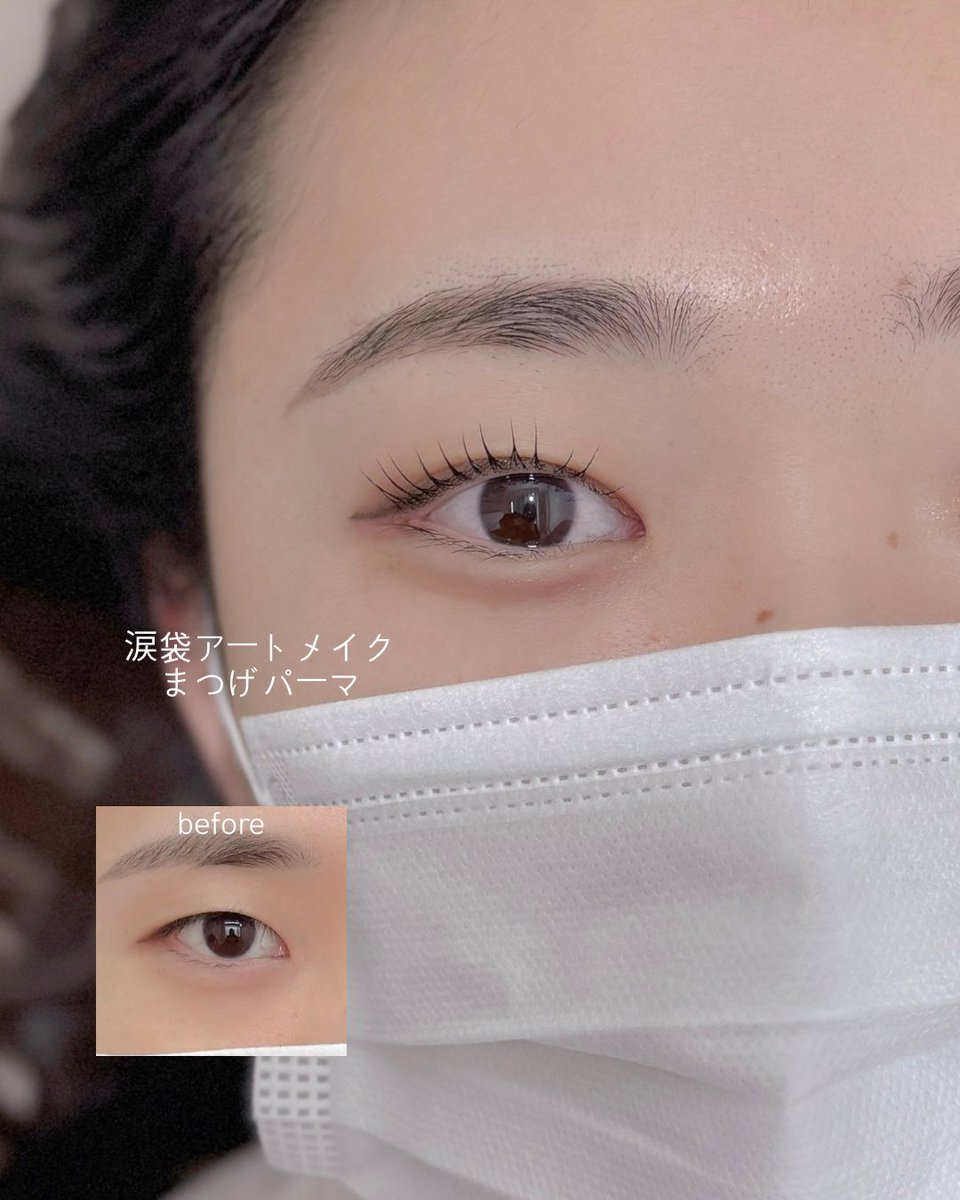 nokiedit's tweet photo. 【涙袋アートメイク + まつげパーマ】

縦幅のある、ぱっちりとした目元へ。

お客様の目の形に合わせて
シェーディングだけで
自然な涙袋をデザインしました。

可愛らしい目元を、より魅力的に💕

ご予約���こちら https://t.co/eFq4GJtgqZ

#涙袋 #江南メイク #渡韓 #韓国アートメイク https://t.co/vVjc9FLI4q