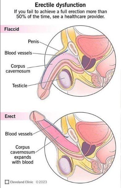 darw1nsz's tweet photo. 9 Vitaminas recomendadas para hombres que sufren de disfunción eréctil 

(Estas son cosas de las que no hablan muchos médicos)

1. Vitamina D3 https://t.co/6yan8C49Du