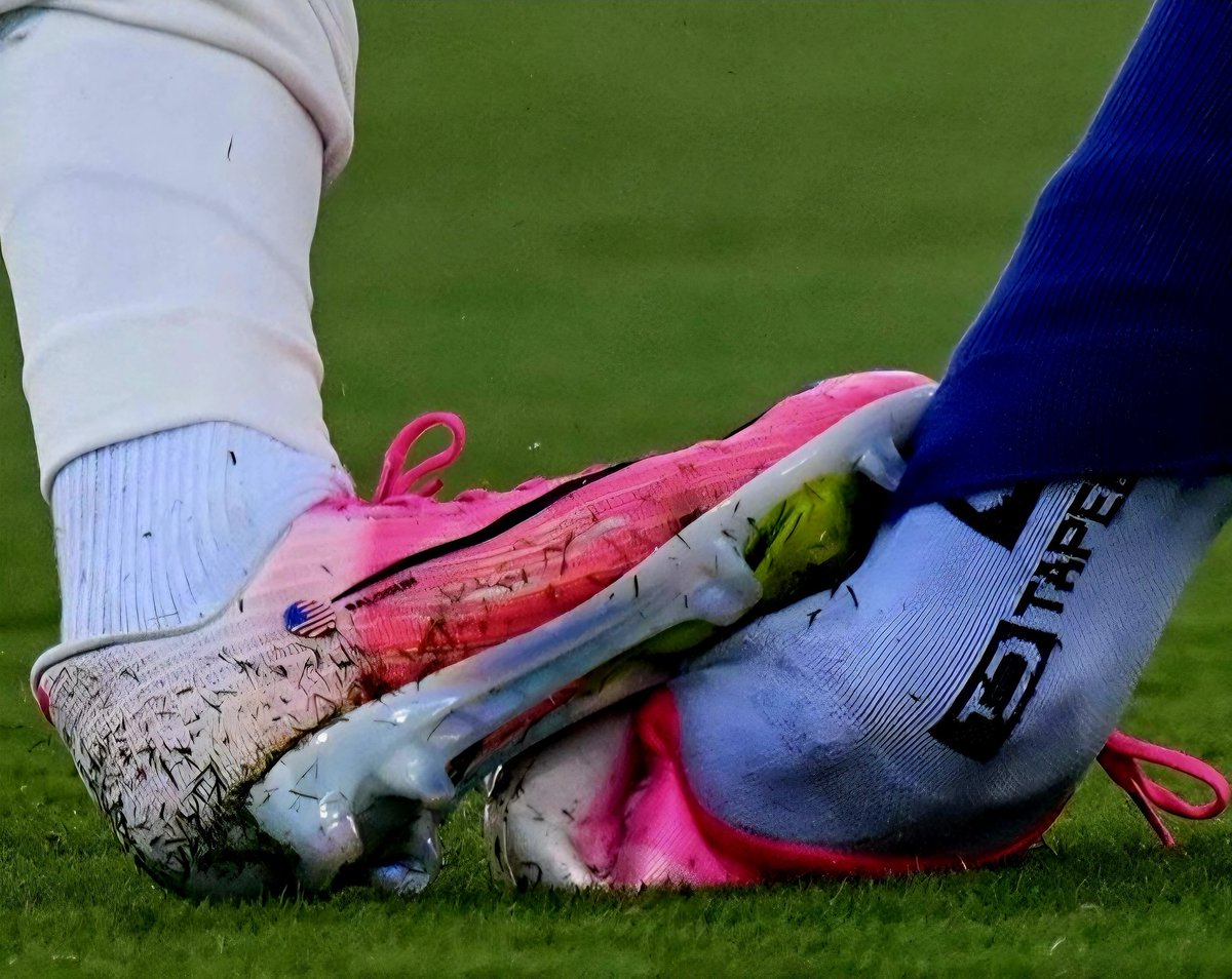Anonymous00708's tweet photo. Blitzbirne #Trump soeben in einer PK zum Foul von #Balogun:

"Er hat ja nichts falsch gemacht"

FCK TRUMP!
FCK #FIFA!

#Wochenstart #Korruption https://t.co/pfGnXynoKK