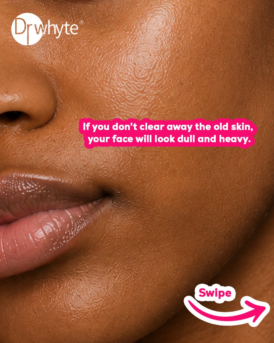 drwhytesoapng's tweet photo. If your skin looks a bit dull lately, this is why 

Just washing with normal soap isn't enough to bring out your glow. You need something that gently lifts off the old, dead skin so the fresh layer can show.

#DrWhyte #DrWhyteSoap #SkincareNigeria #BodycareRoutine https://t.co/ppMi3hc06g