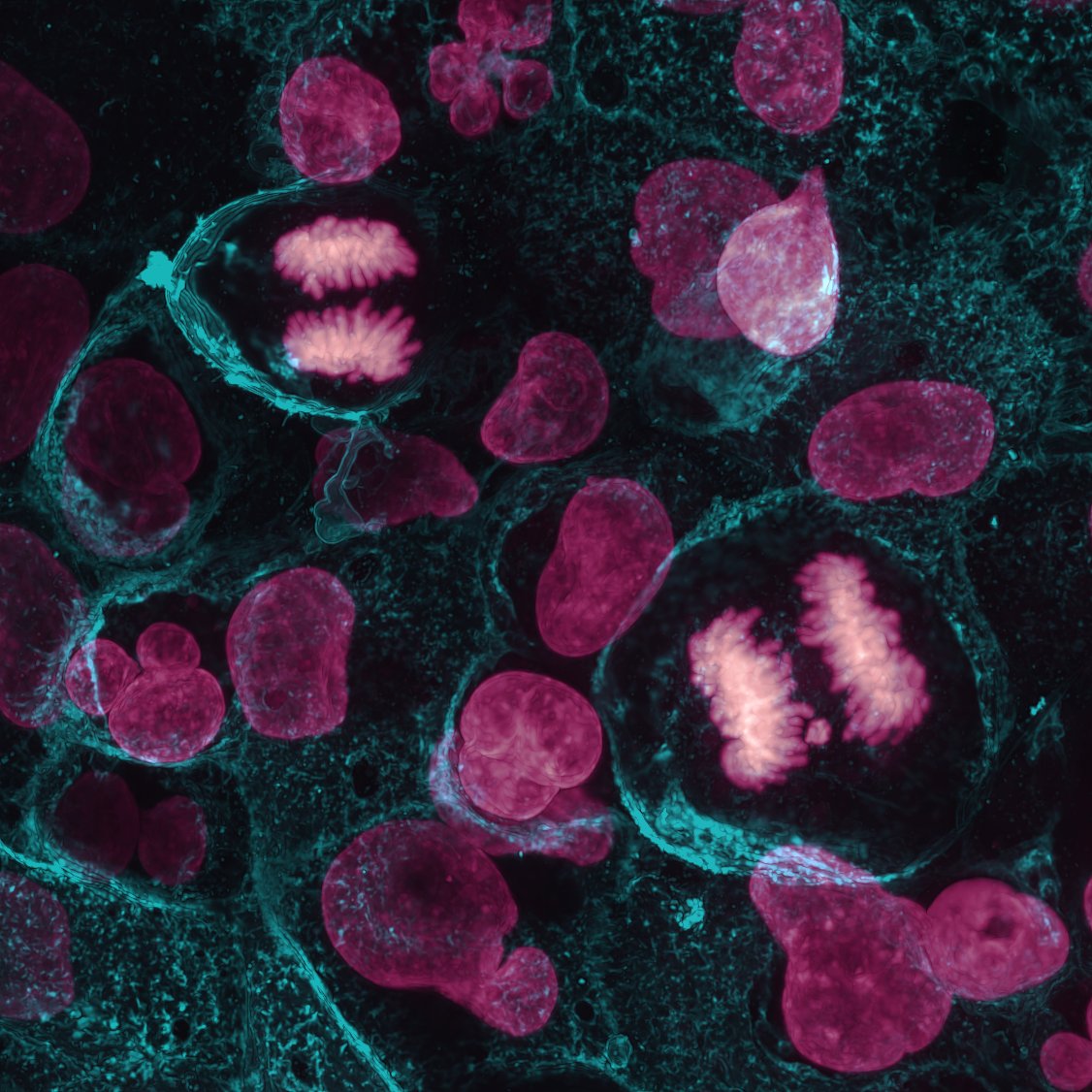 UABSurgery's tweet photo. Take a look under the microscope! 🔬 

Here are a few recent snapshots from the Rose-Guenter Lab. The team uses mechanistic discovery and patient-centered innovation to develop new targeted treatment strategies for pancreatic and neuroendocrine cancers.

📸: Jasmine Watts https://t.co/GV2UVRQyaj