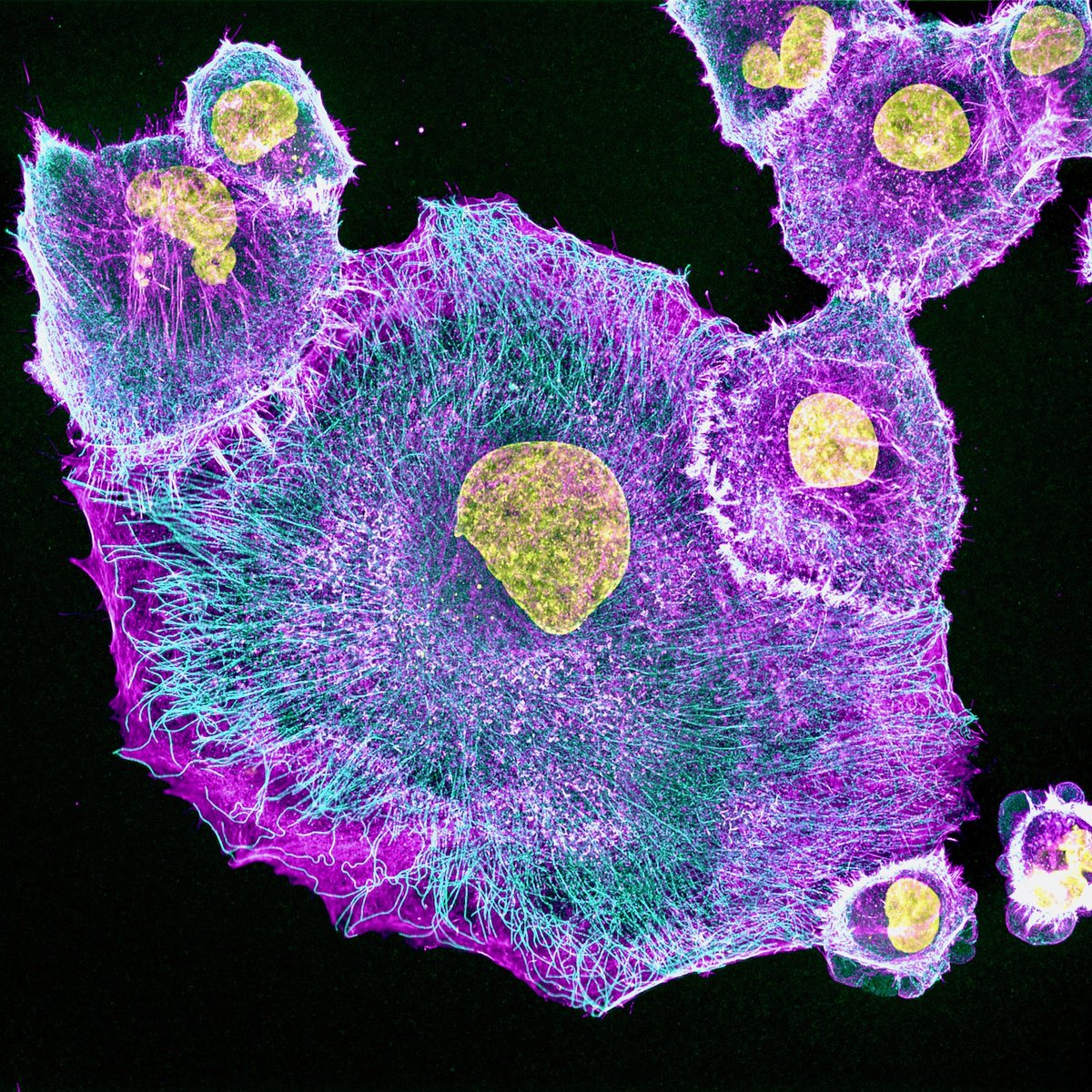 UABSurgery's tweet photo. Take a look under the microscope! 🔬 

Here are a few recent snapshots from the Rose-Guenter Lab. The team uses mechanistic discovery and patient-centered innovation to develop new targeted treatment strategies for pancreatic and neuroendocrine cancers.

📸: Jasmine Watts https://t.co/GV2UVRQyaj