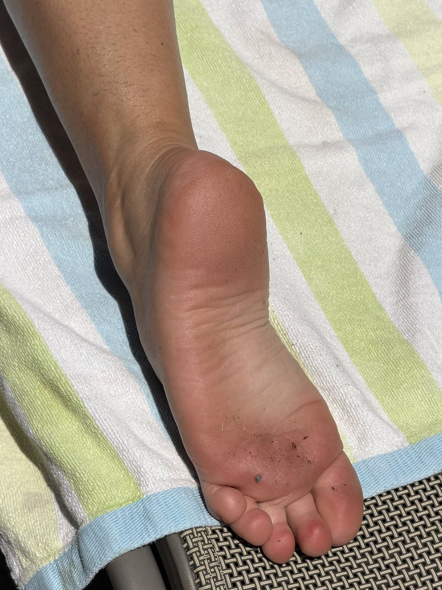 Isabels_Feet's tweet photo. @FeetReligion Clean them https://t.co/td4pcOjSNW