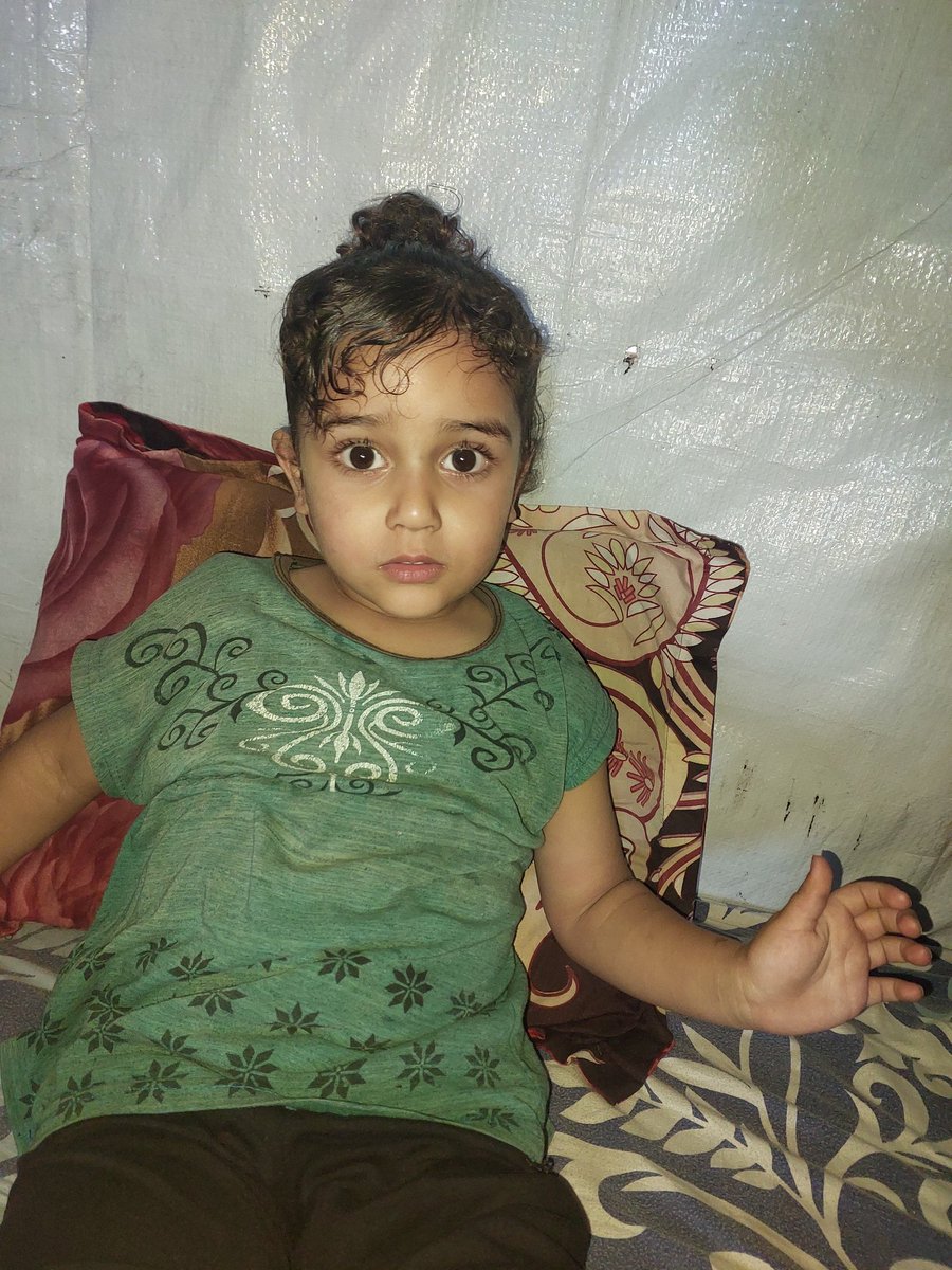 wdmr28280815's tweet photo. Dear friends, I implore you to help me provide healthy food for my son, Mazen. He is suffering from malnutrition and a severely weakened immune system. My daughter, Massa is also suffering from skin problems due to the extreme heat inside the tent
Please🙏
https://t.co/OJ4FRArqSy https://t.co/zQL1EL7Izg