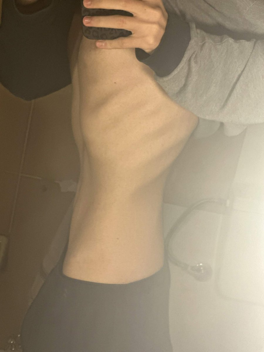bowtiedribs's tweet photo. back when i was 58 kgs😭i need to lock in #ana #edtwt #proana #prorecovery #ed https://t.co/cioUdt5PtC