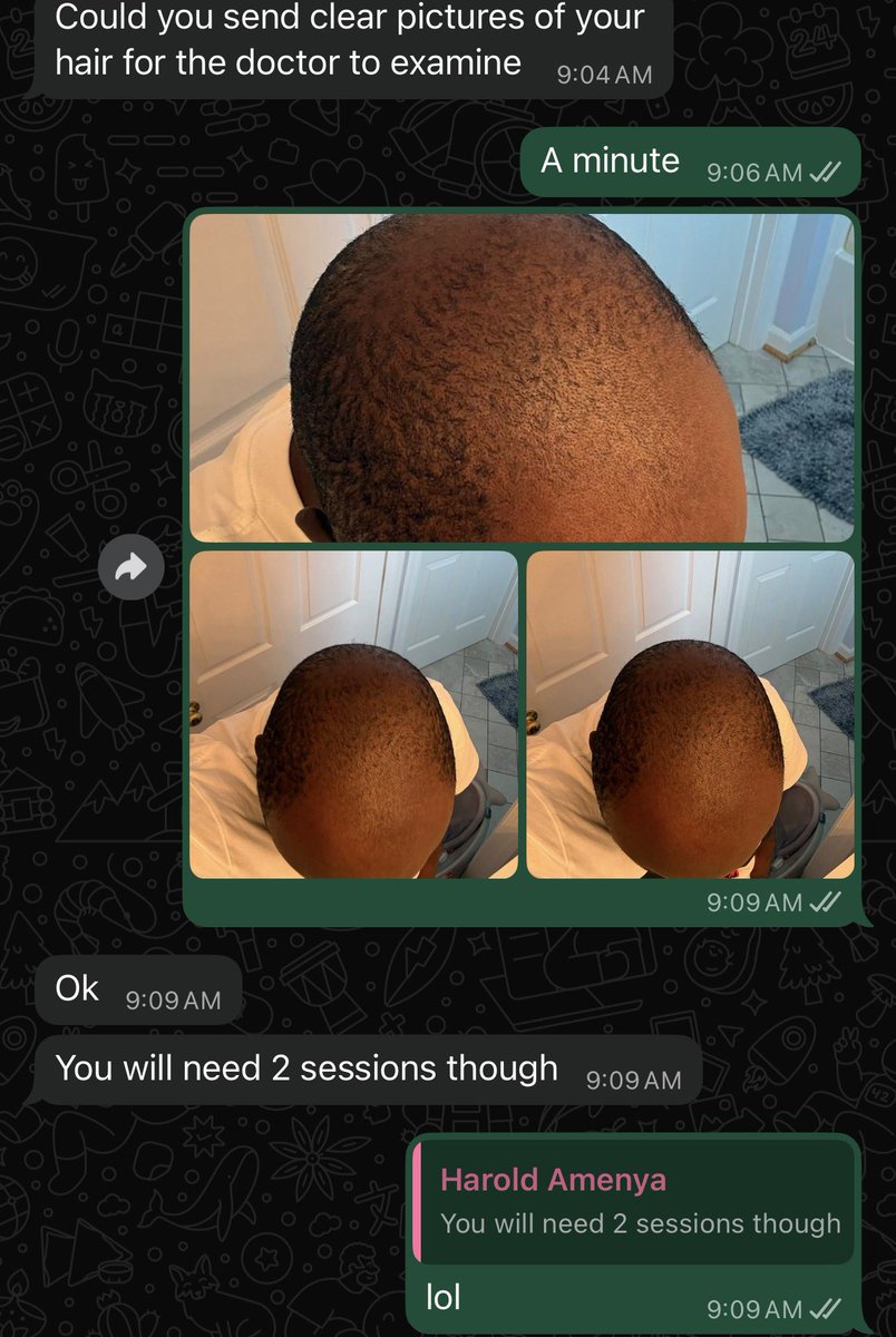 kwadwosheldon's tweet photo. Me trying to get hair Transplant.. https://t.co/EubPRGJAvY