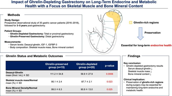 surgery81261's tweet photo. 💡Throwback to one of our most popular posts!
A prospective study showed that gastrectomy removing ghrelin-rich regions led to long-term reductions in serum ghrelin, skeletal muscle mass, and bone mineral content.⬇️Lower IGF-1 correlated with muscle loss, highlighting the need to consider endocrine and metabolic consequences when selecting surgical approaches.📷 https://t.co/WUewIj4Jee #AGSurg