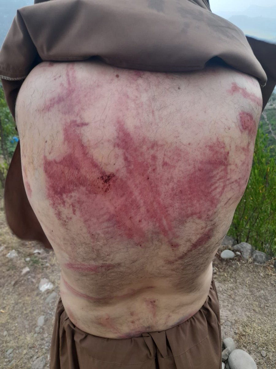 NarrativeFiles's tweet photo. 🚨 Shameful Brutality

Banned JAAC’s masked terrorists savagely tortured a traders’ leader for 6 hours - Just for making way for an ambulance. 🚑

Beating him half to death exposes their true face:
They’re not fighting for rights - They’re pushing an enemy agenda. ⚠️
This isn’t activism. It’s pure terrorism. ❌