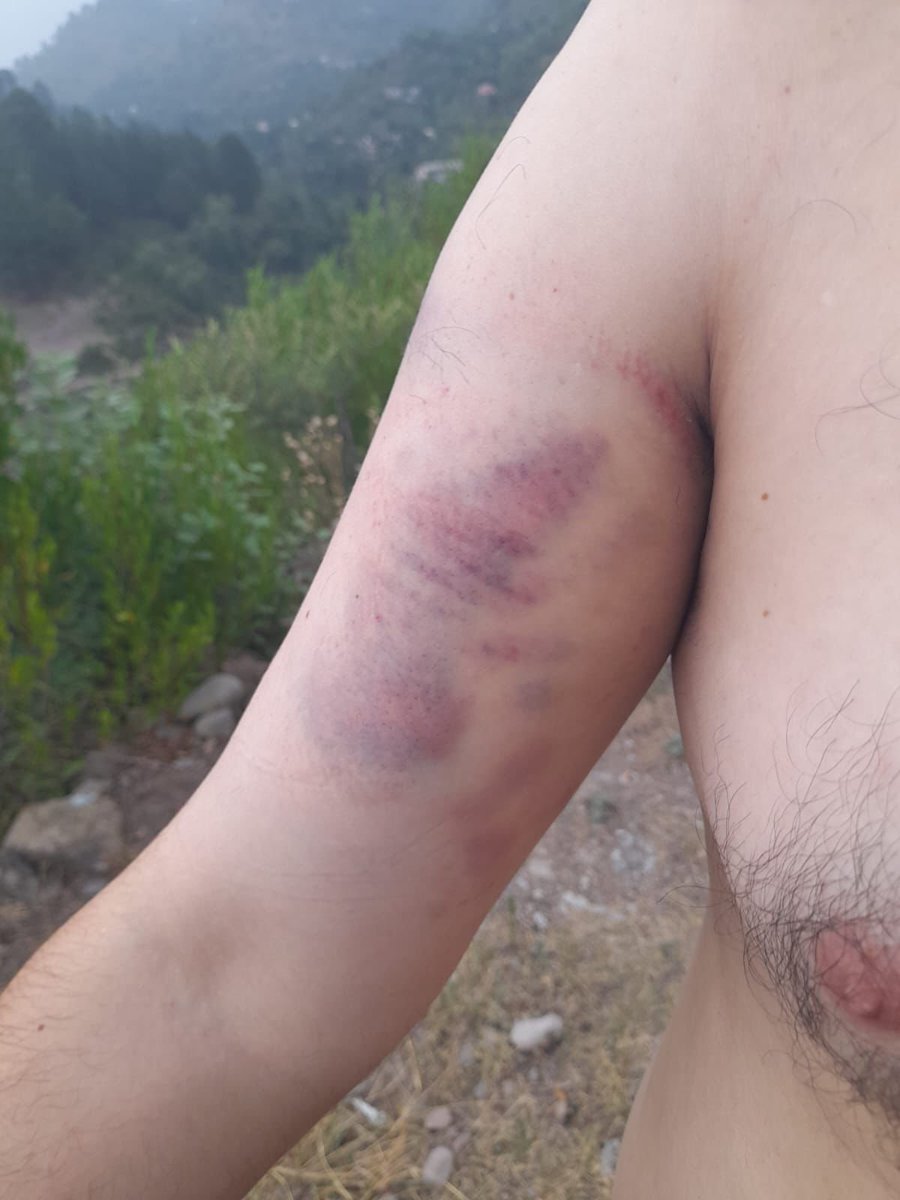 NarrativeFiles's tweet photo. 🚨 Shameful Brutality

Banned JAAC’s masked terrorists savagely tortured a traders’ leader for 6 hours - Just for making way for an ambulance. 🚑

Beating him half to death exposes their true face:
They’re not fighting for rights - They’re pushing an enemy agenda. ⚠️
This isn’t activism. It’s pure terrorism. ❌