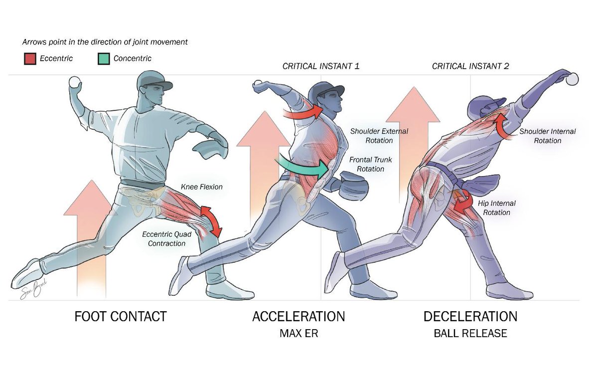 PhysioAcademia7's tweet photo. ⚾️ 野球のパワーは腕の強さだけで決まるのか？ 💥

野球でパワーの話になると、多くの人はまず腕の強さを考えます。

投手であれば、
👉「肩が強い」
打者であれば、
👉「手が速い」(英語での表現)

と言われることがあります。

もちろん、肩、腕、手首、手の機能は重要です。

しかし、投球や打撃のパワーの多くは、腕やバットが加速する前にすでに生み出されています。

野球のパワーの大きな源は、
👉 下肢、股関節、骨盤、体幹
にあります。

腕だけでパワーを作っているわけではありません。

腕は、キネティックチェーンを通して先に生み出されたエネルギーを受け取り、最終的にボールやバットへ伝える役割を担っています。

📊 研究より：
• 投球では、股関節は膝よりも大きなエネルギーを生み出し、特に後ろ脚側の股関節が動作を大きく駆動する (de Swart et al., 2022)
• 若年投手では、下肢のキネティックチェーンを上がるにつれてパワー生成が増加し、前脚側股関節や腰仙部が重要な役割を持つ (Pryhoda & Sabick, 2022)
• 軸脚側股関節は大腿から骨盤へのエネルギー伝達を助け、前脚側股関節は骨盤回旋のエネルギー生成に関与する (Kimura et al., 2020)
• 地面反力の研究では、後ろ脚は推進力を作り、前脚はブレーキをかけながら上半身や投球腕へエネルギーを伝える役割を持つ (Howenstein et al., 2020)
• 打撃では、股関節トルクを通して下部体幹へ力学的エネルギーが流入し、両側の股関節がエネルギー生成源として働く (Horiuchi et al., 2017; Horiuchi et al., 2021)
• 投球では、体幹が主要なエネルギー源となり、肩や肘は主にエネルギーを伝達する部位として機能する (Naito, 2021)

⚙️ なぜ股関節筋力が重要なのか？
投球と打撃では、エネルギーが順番に伝わります。

地面
→ 下肢
→ 股関節
→ 骨盤
→ 体幹
→ 肩・腕
→ ボールまたはバット

股関節は、力を生み出し、受け止め、方向を変え、上半身へ伝える役割を持っています。

投手では、後ろ脚側の股関節がホーム方向への勢いを作り、前脚側の股関節が安定性と回旋、そして体幹へのエネルギー伝達を助けます。

打者では、股関節が回旋パワーを生み出し、そのエネルギーを体幹からバットへ伝えます。

股関節が十分に力を発揮できない、またはコントロールできない場合、身体は体幹、肩、肘、腕で代償しようとする可能性があります。

その結果、パフォーマンス低下や特定部位への過剰な負担につながるかもしれません。

⚠️ ただし「股関節だけ」ではありません
この研究結果が意味するのは、

❌「腕の強さは関係ない」
❌「股関節だけ鍛えればいい」

ということではありません。

より正確には、

✅ 腕は重要だが、腕だけに注目すべきではない。
✅ 股関節筋力、体幹機能、エネルギー伝達が野球のパワーに大きく関わる。
✅ 優れた選手は、強い腕だけでなく、効率的なキネティックチェーンを持っている。

ということです。

🛠️ 実践ポイント
• 股関節伸展、回旋、外転、内転など、多方向の筋力を鍛える
• 後ろ脚の推進力と前脚のブレーシング能力を両方鍛える
• メディシンボールスローやケーブルローテーションなど、回旋パワー種目を取り入れる
• 片脚筋力と片脚コントロールを高める
• 股関節筋力を体幹コントロールや上半身の動きと統合する
• 下半身で生み出した力を実際の投球・打撃動作へ伝えられているか評価する

👉 野球のパワーは腕から始まるわけではない。
👉 地面から始まる。
👉 股関節と体幹がそのエネルギーを生み出し、伝える。
👉 腕はそのパワーを最後に表現する部位である。

💬 あなたは投球・打撃パワーを鍛える時、腕を重視していますか？それとも股関節とキネティックチェーンも評価していますか？