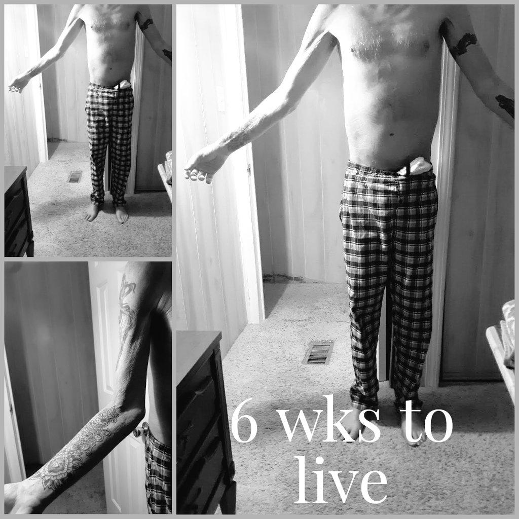 modernTman's tweet photo. 24. That is the ultimate gate. I had to almost die—had to be drained of 19 liters of fluid and drop to 110 lbs—to find it. But 8 months of #FoodIntelligence proved the resurrection is real. https://t.co/3HZEcD4EX0