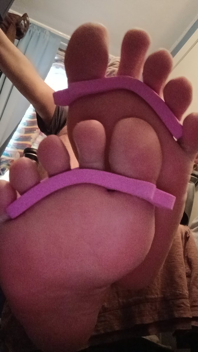 SurferSole14765's tweet photo. are my feet too big or are the toe spacers too small? you be the judge ;P https://t.co/5bvVgxyTsz