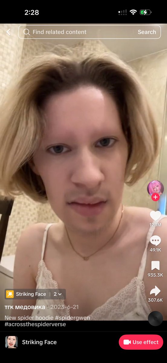 bottomindenile's tweet photo. @D0JACLIT No shade I thought they had the striking face TikTok filter on https://t.co/HTx2e7hwFz